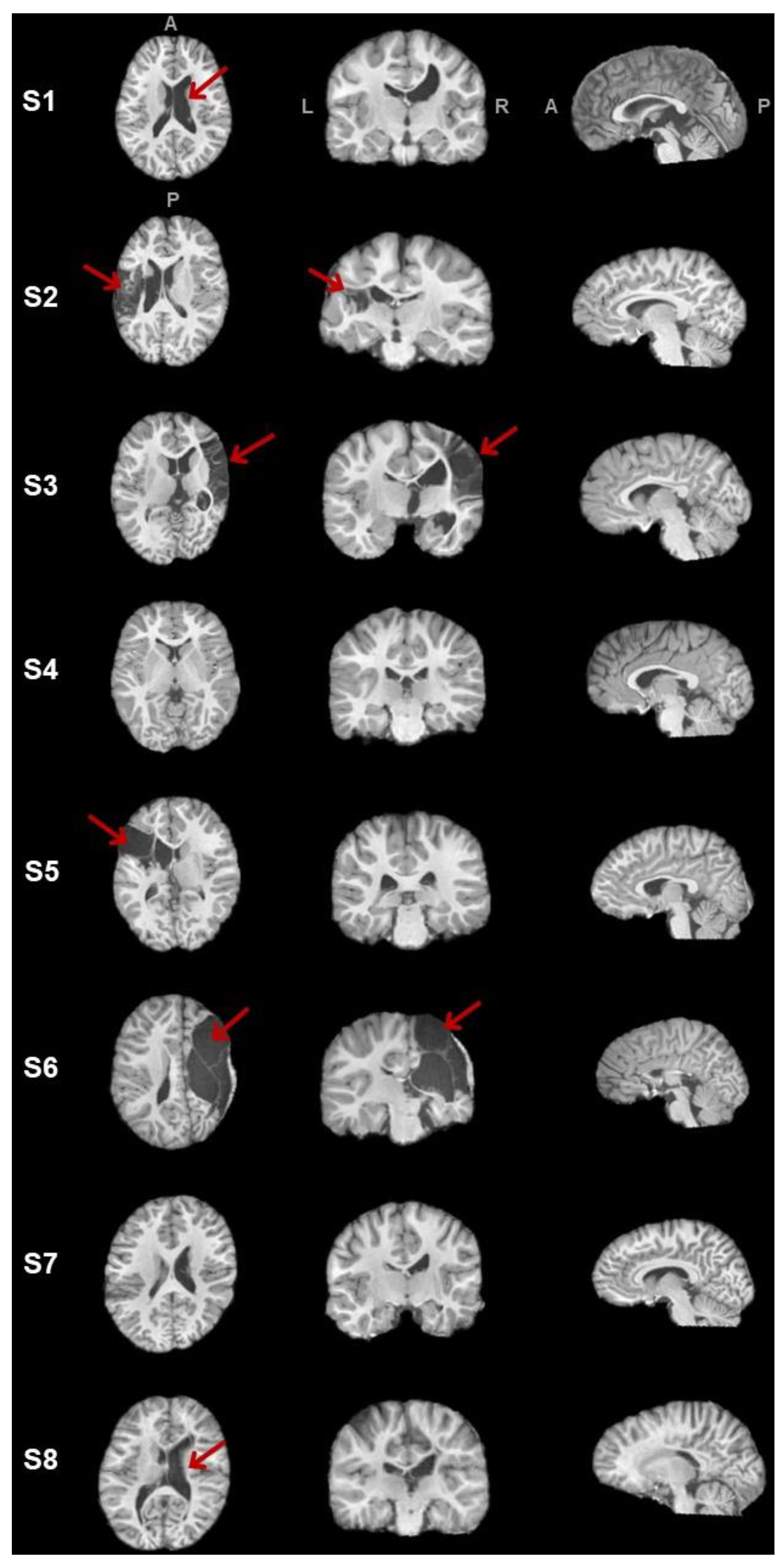 Brainsci 13 01386 g005
