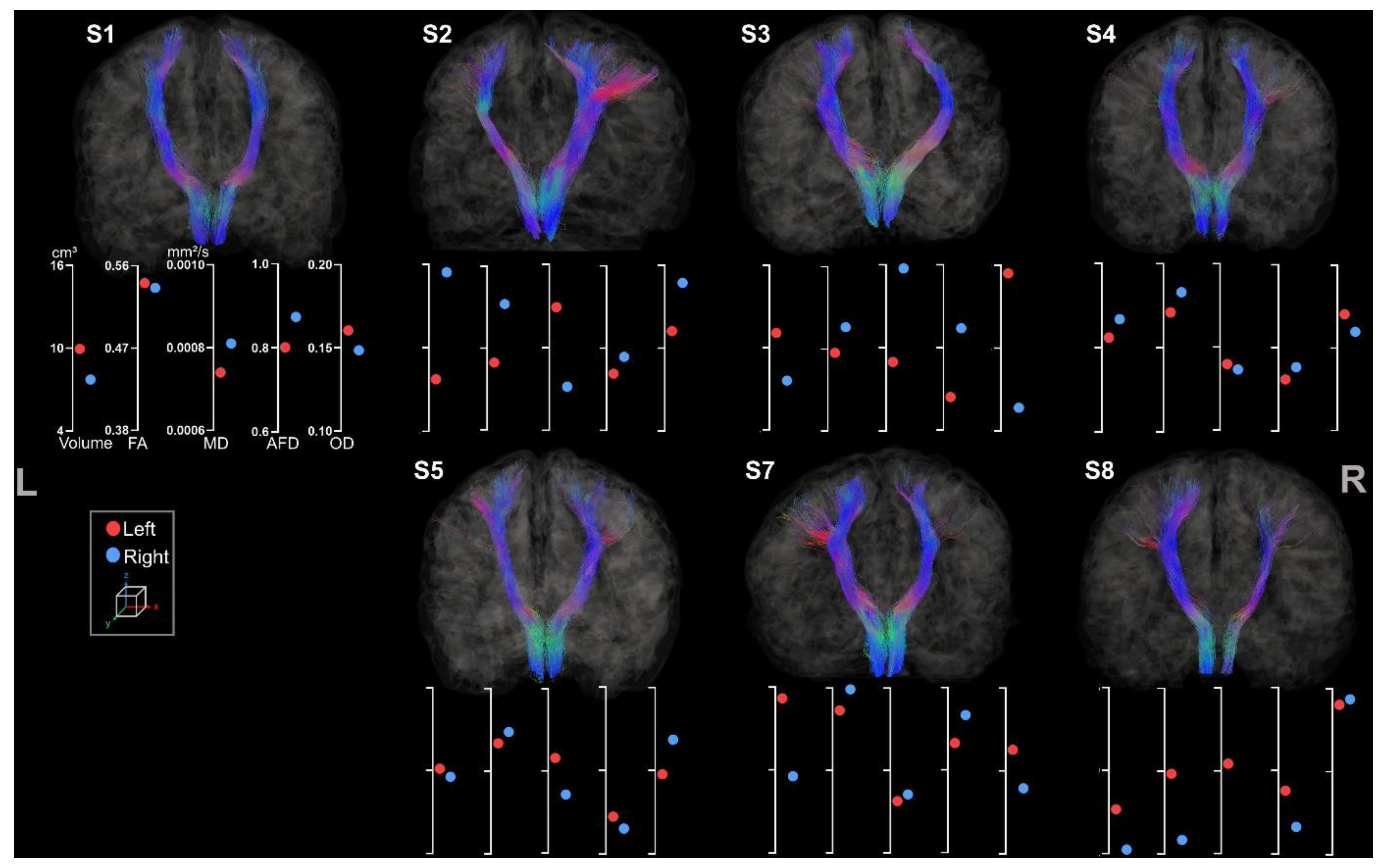 Brainsci 13 01386 g008