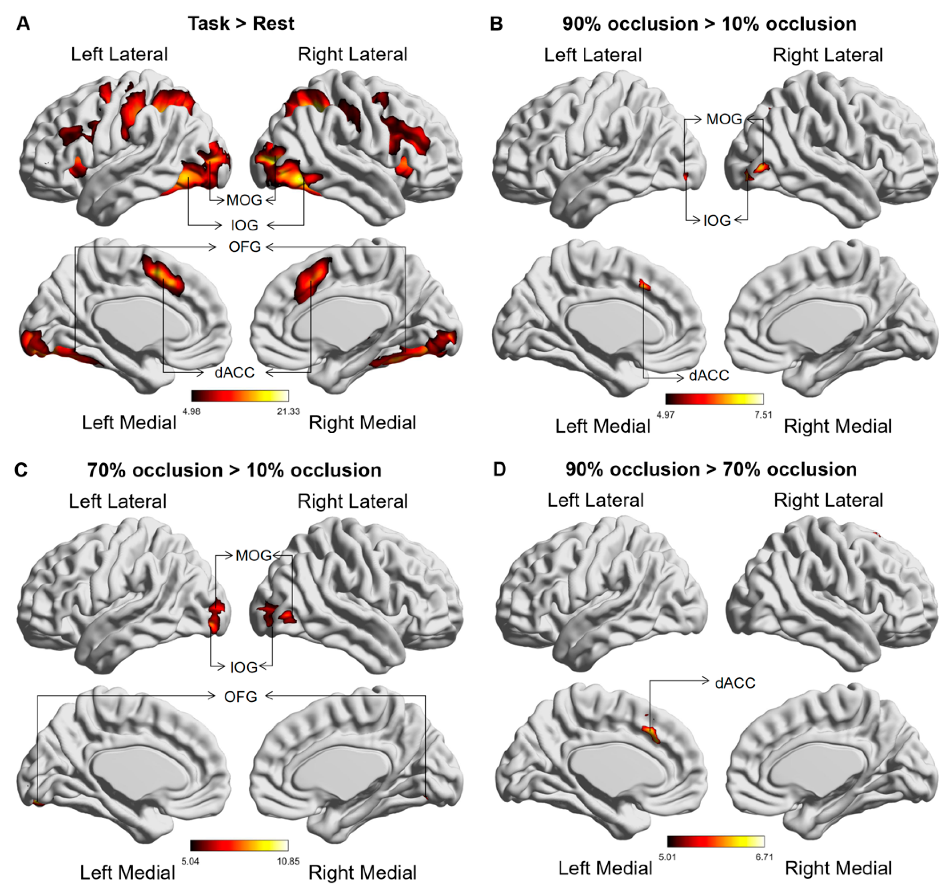 Brainsci 13 01387 g004