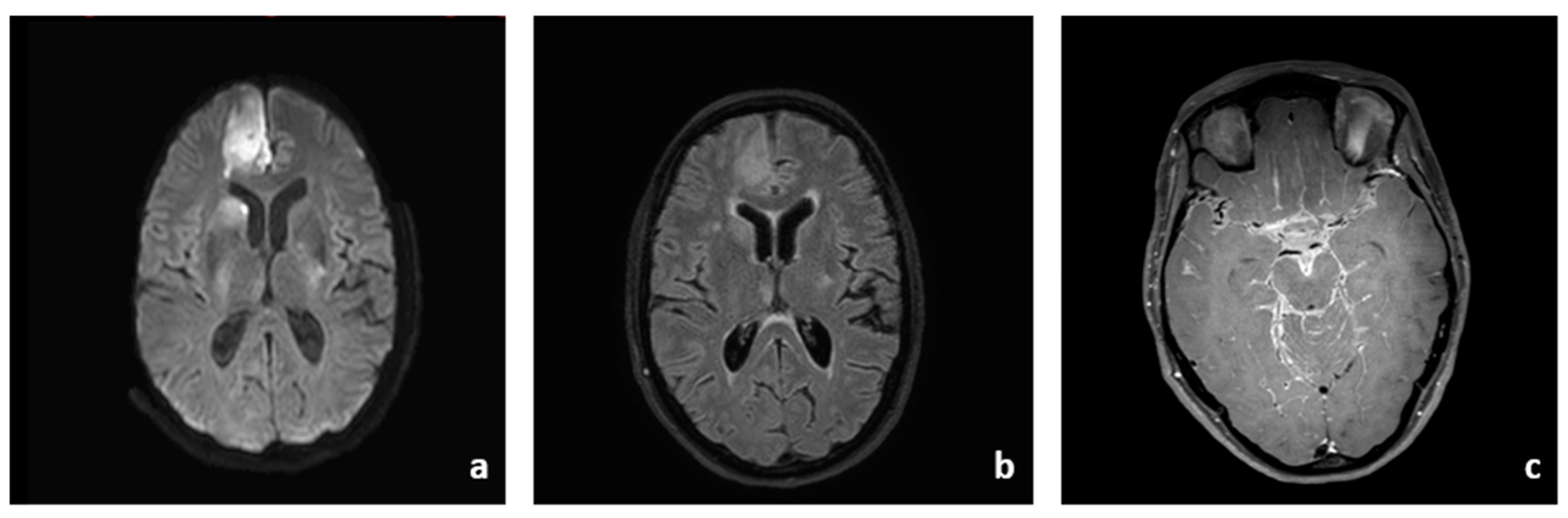 Brainsci 13 01388 g001