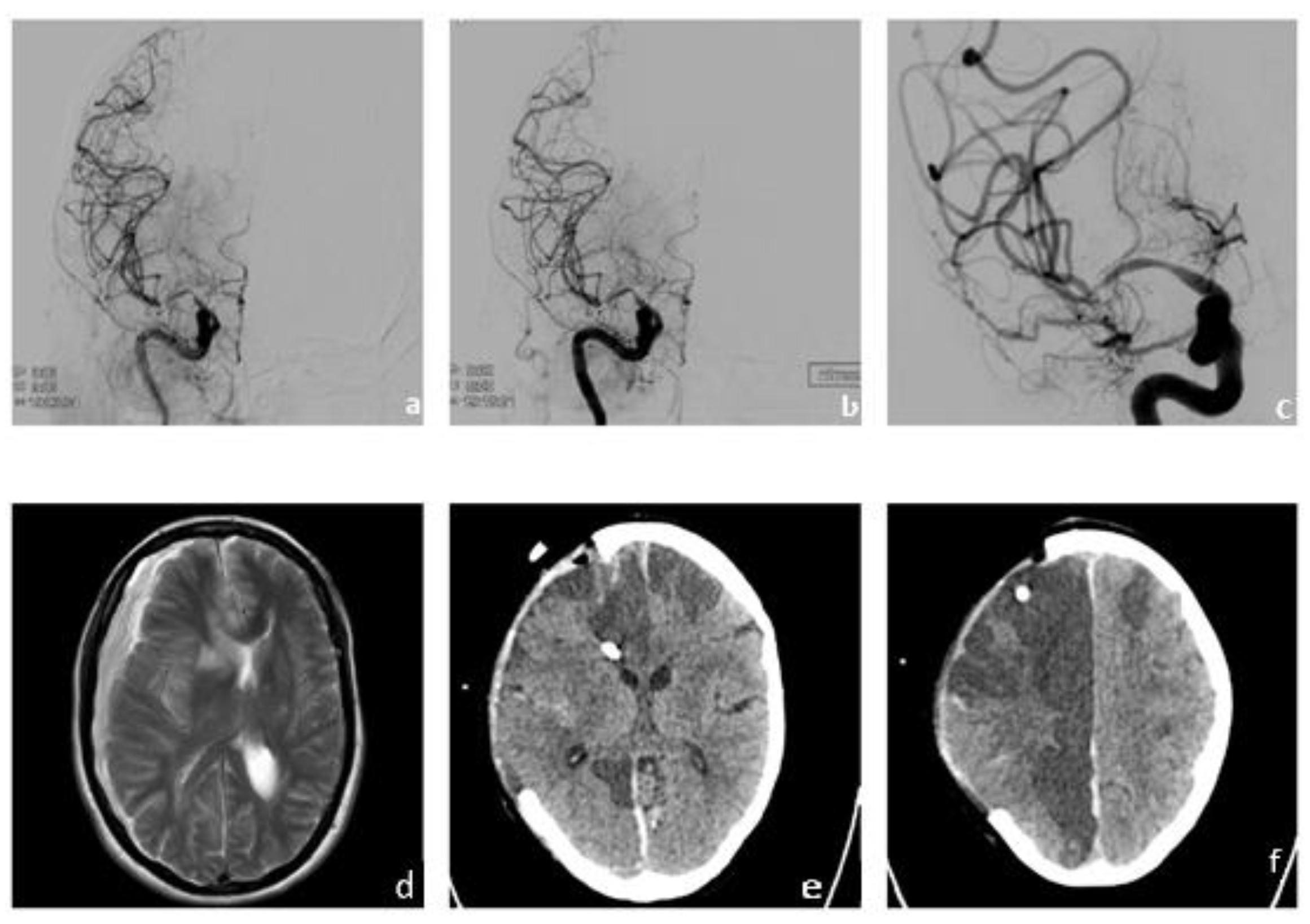 Brainsci 13 01388 g003