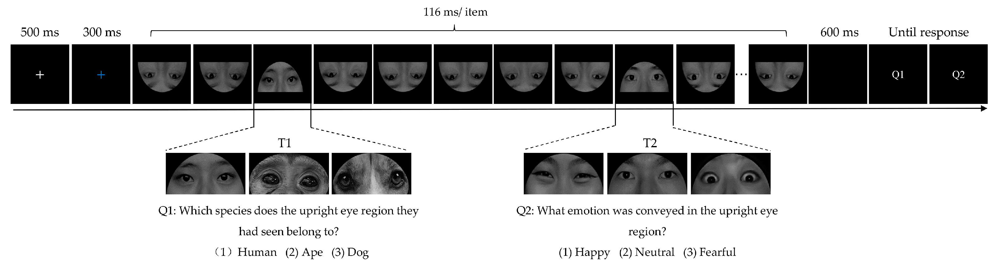 Brainsci 13 01392 g001 Brainsci 13 01392 g001