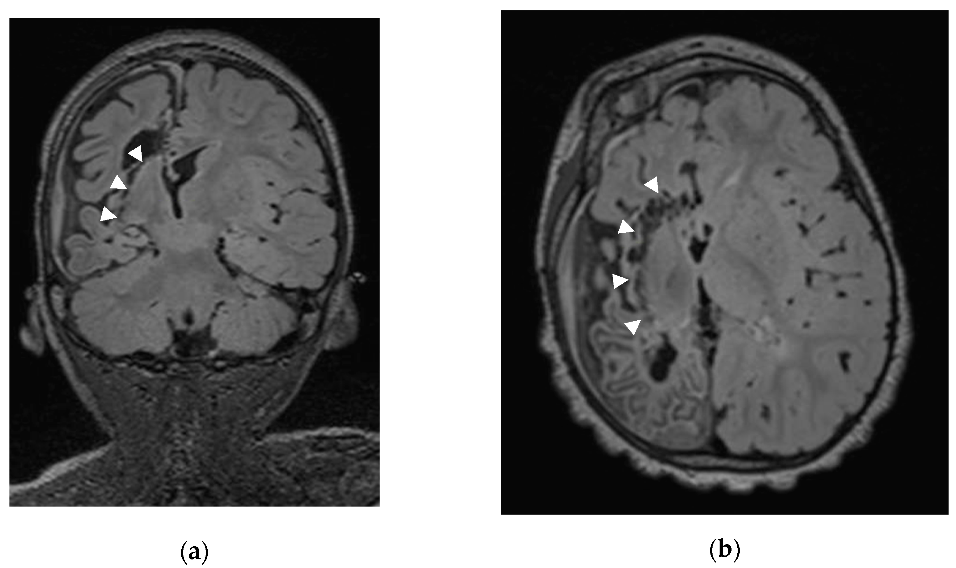 Brainsci 13 01395 g002