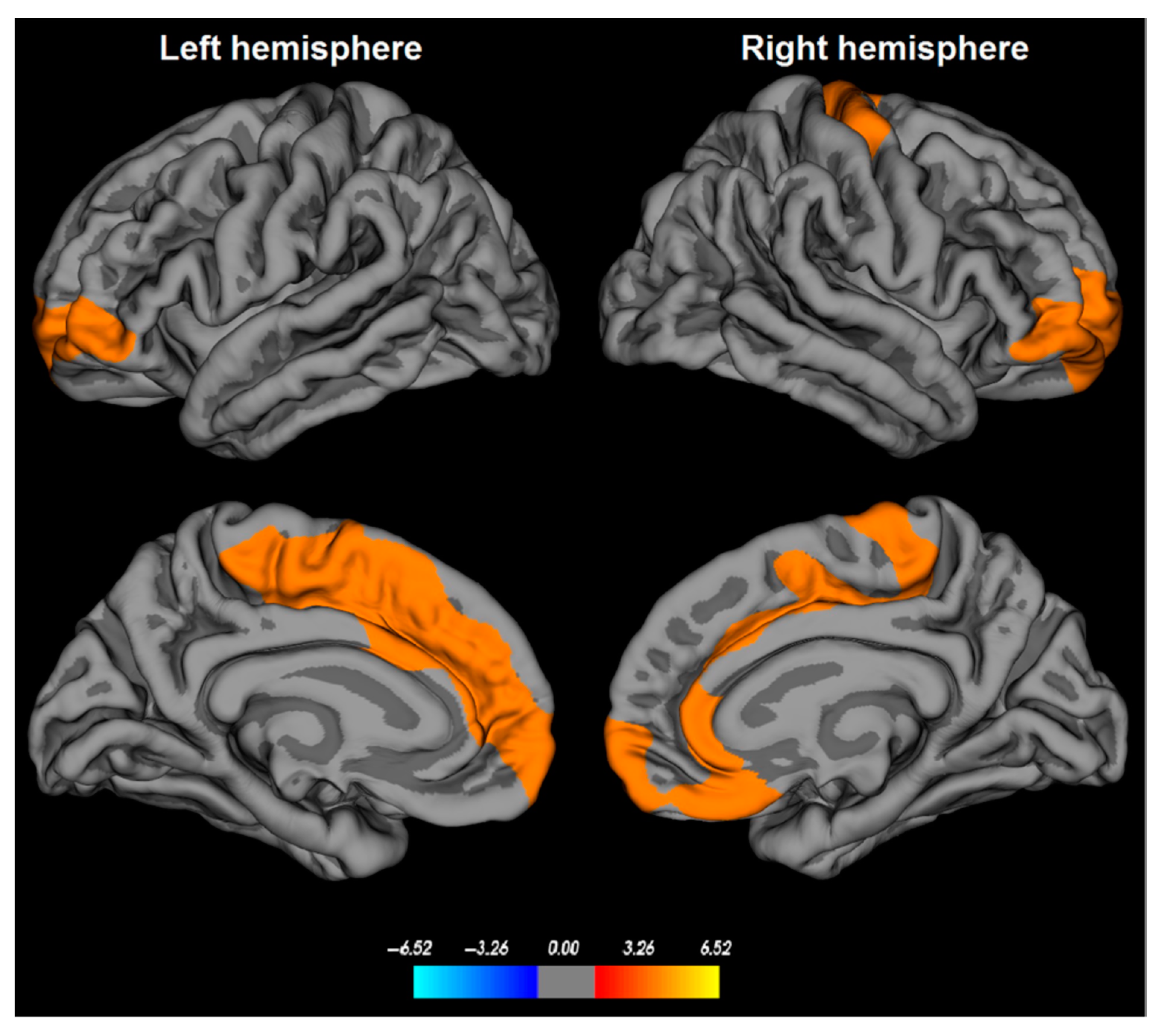 Brainsci 13 01398 g002 Brainsci 13 01398 g002