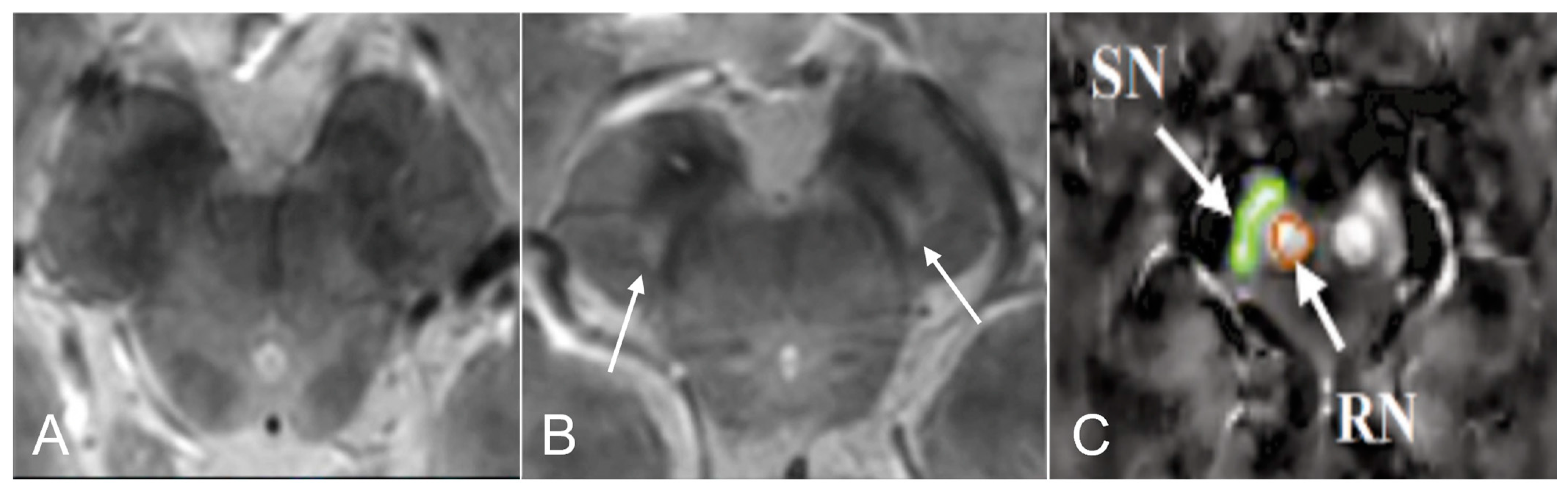 Brainsci 13 01398 g003 Brainsci 13 01398 g003