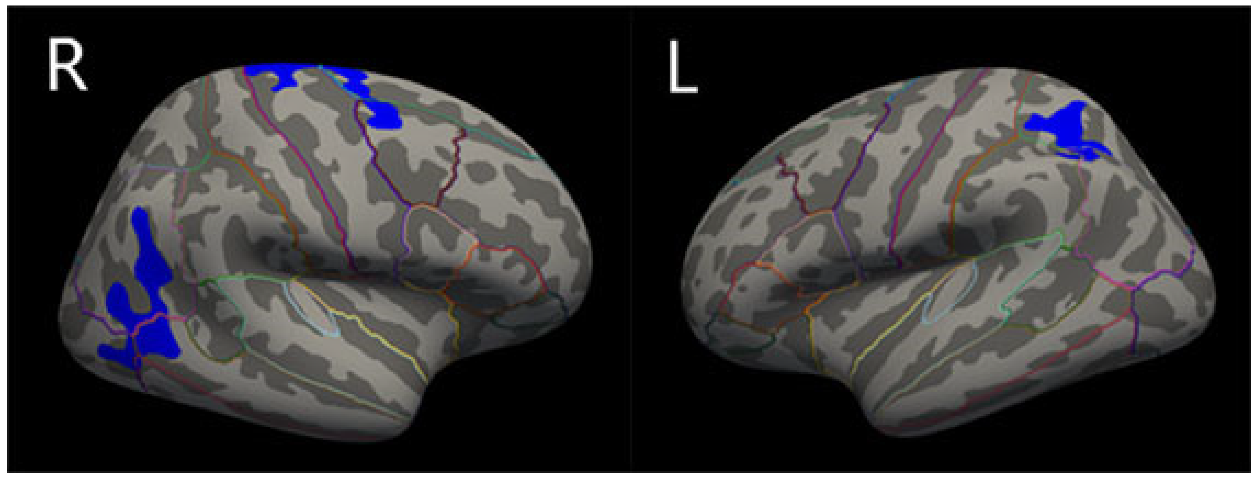 Brainsci 13 01423 g001