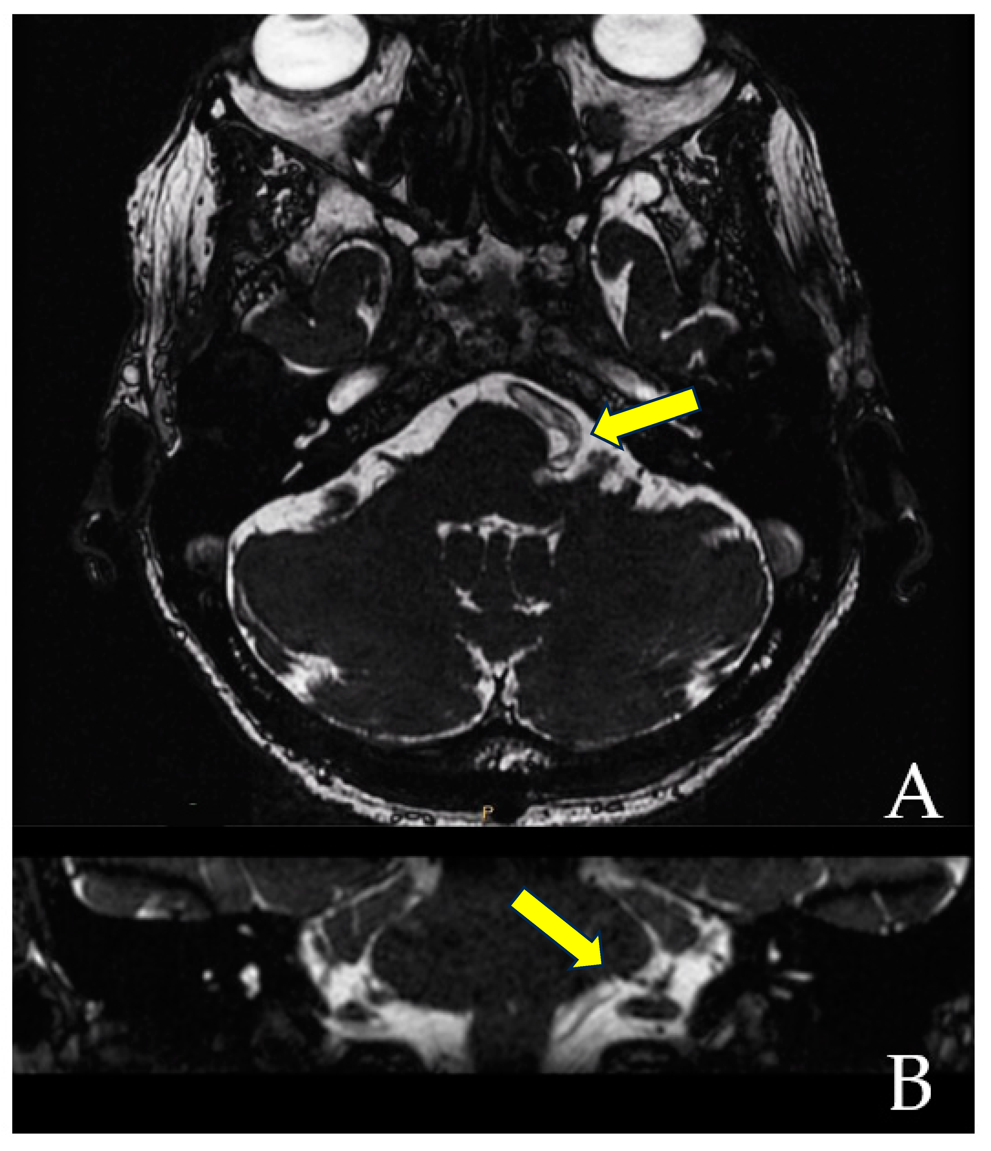 Brainsci 13 01434 g001