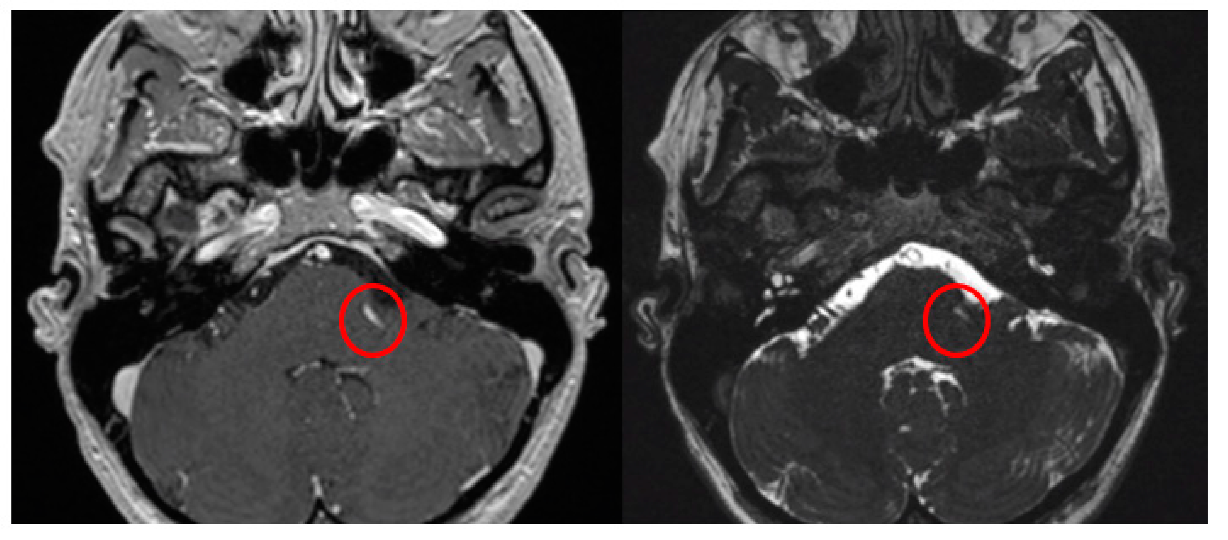 Brainsci 13 01434 g003
