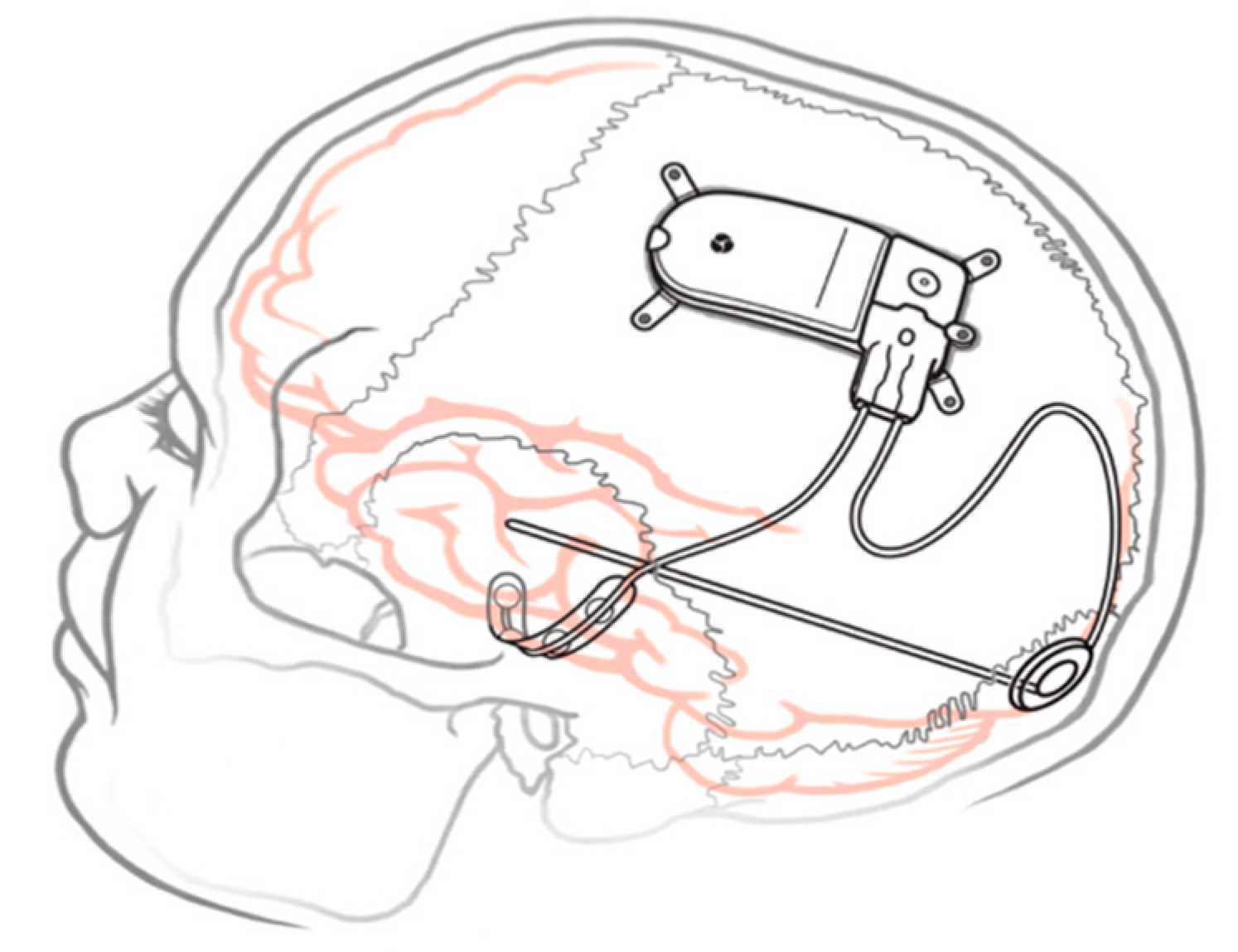 Brainsci 13 01455 g001