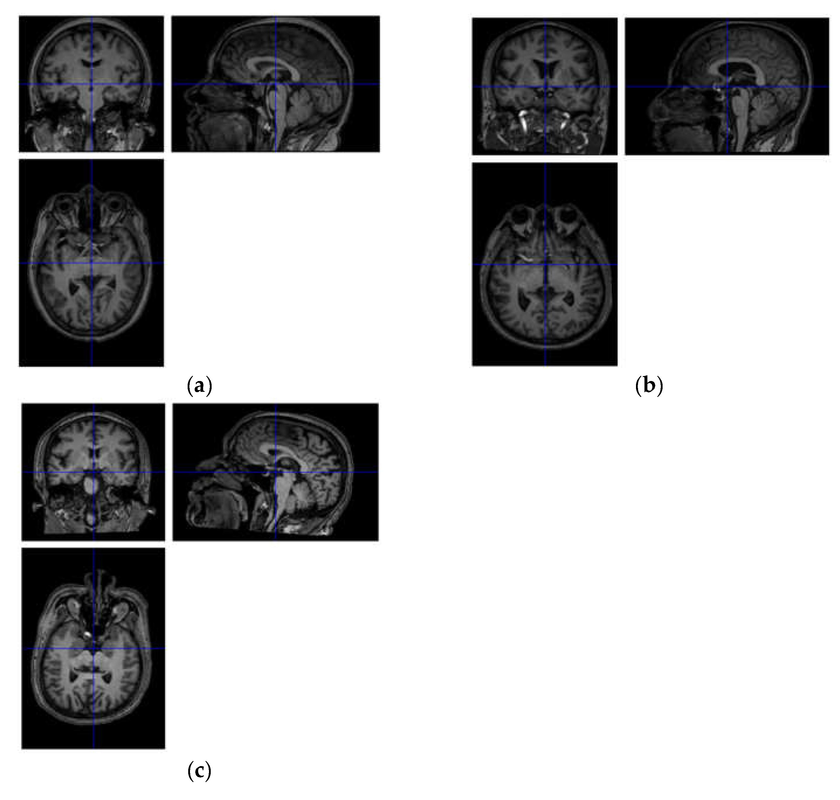 Brainsci 13 01458 g001