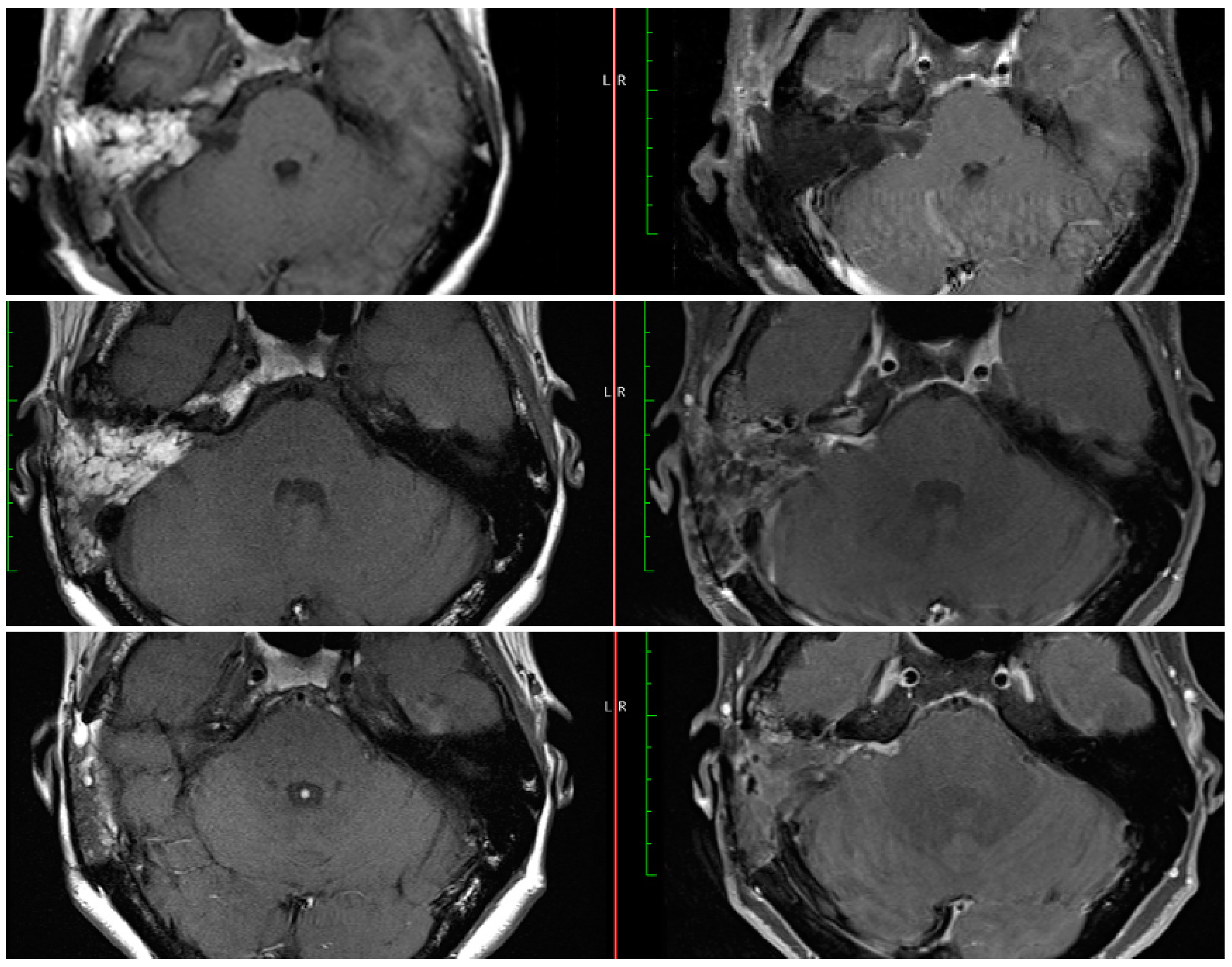 Brainsci 13 01490 g002