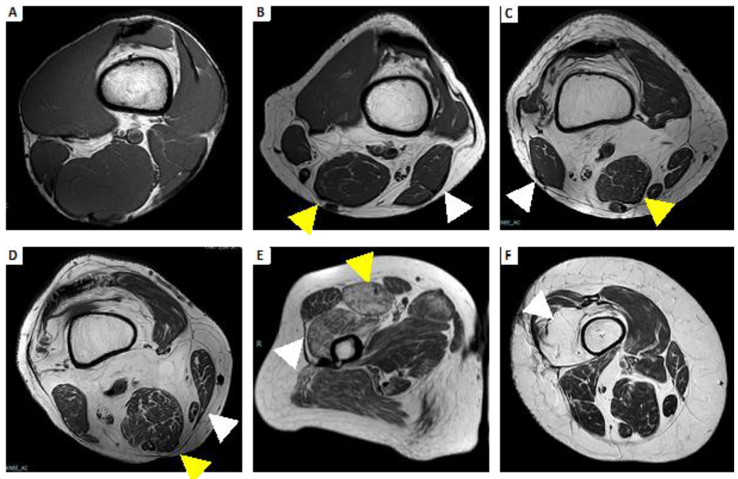 Brainsci 13 01500 g005