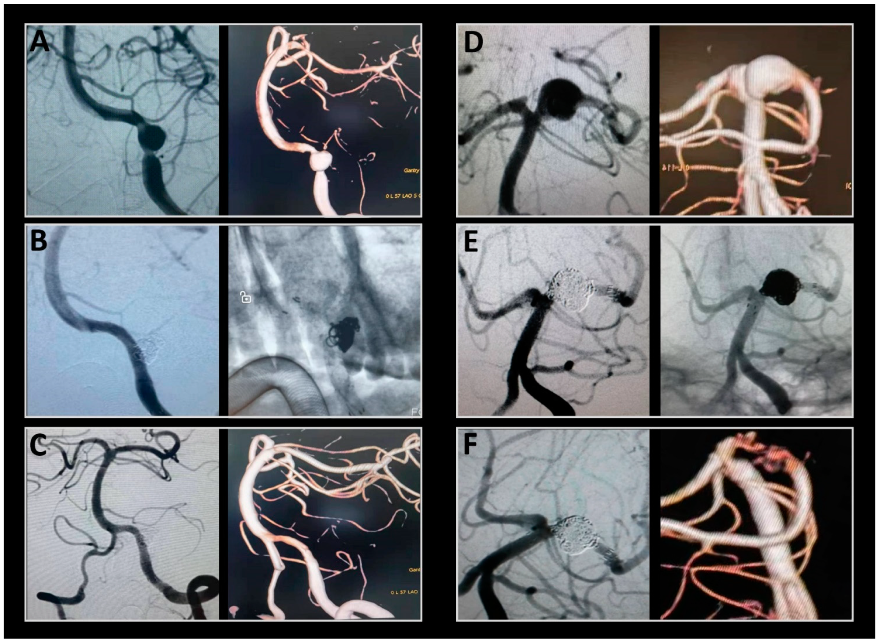 Brainsci 13 01507 g003