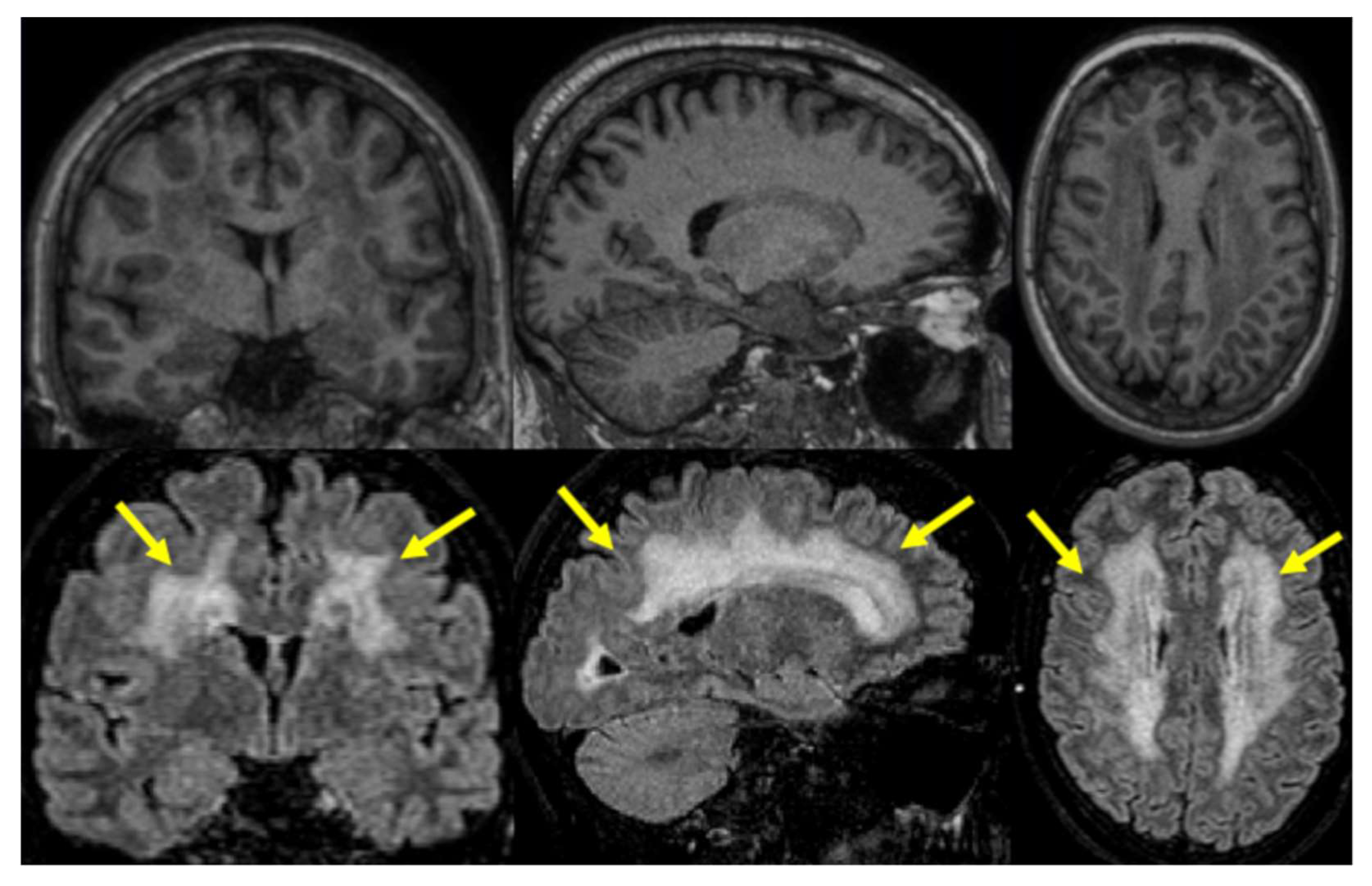 Brainsci 13 01511 g001 Brainsci 13 01511 g001