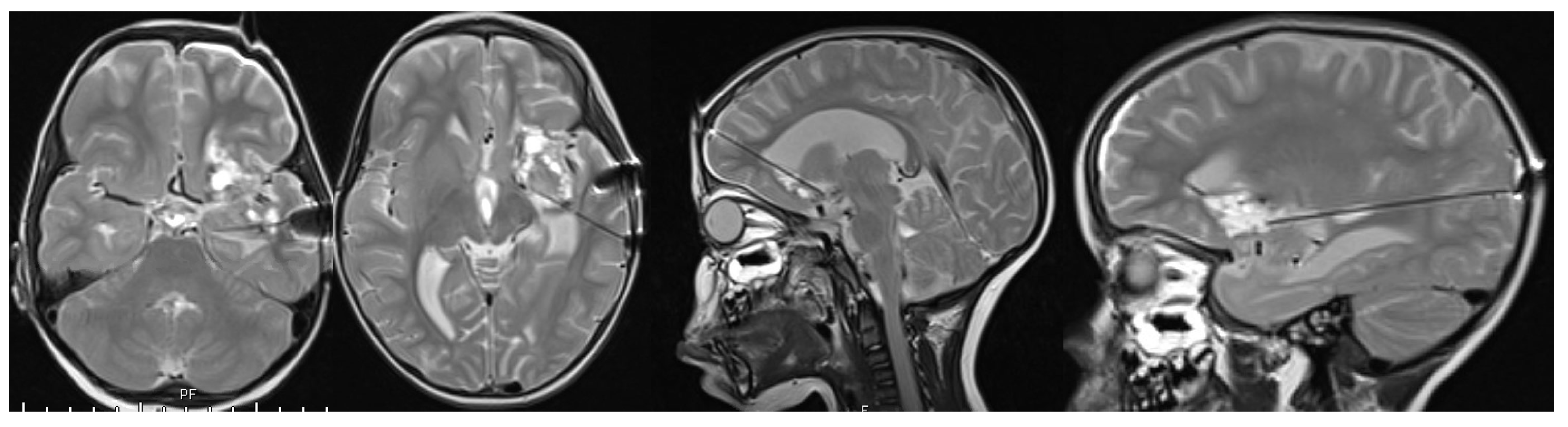 Brainsci 13 01515 g004