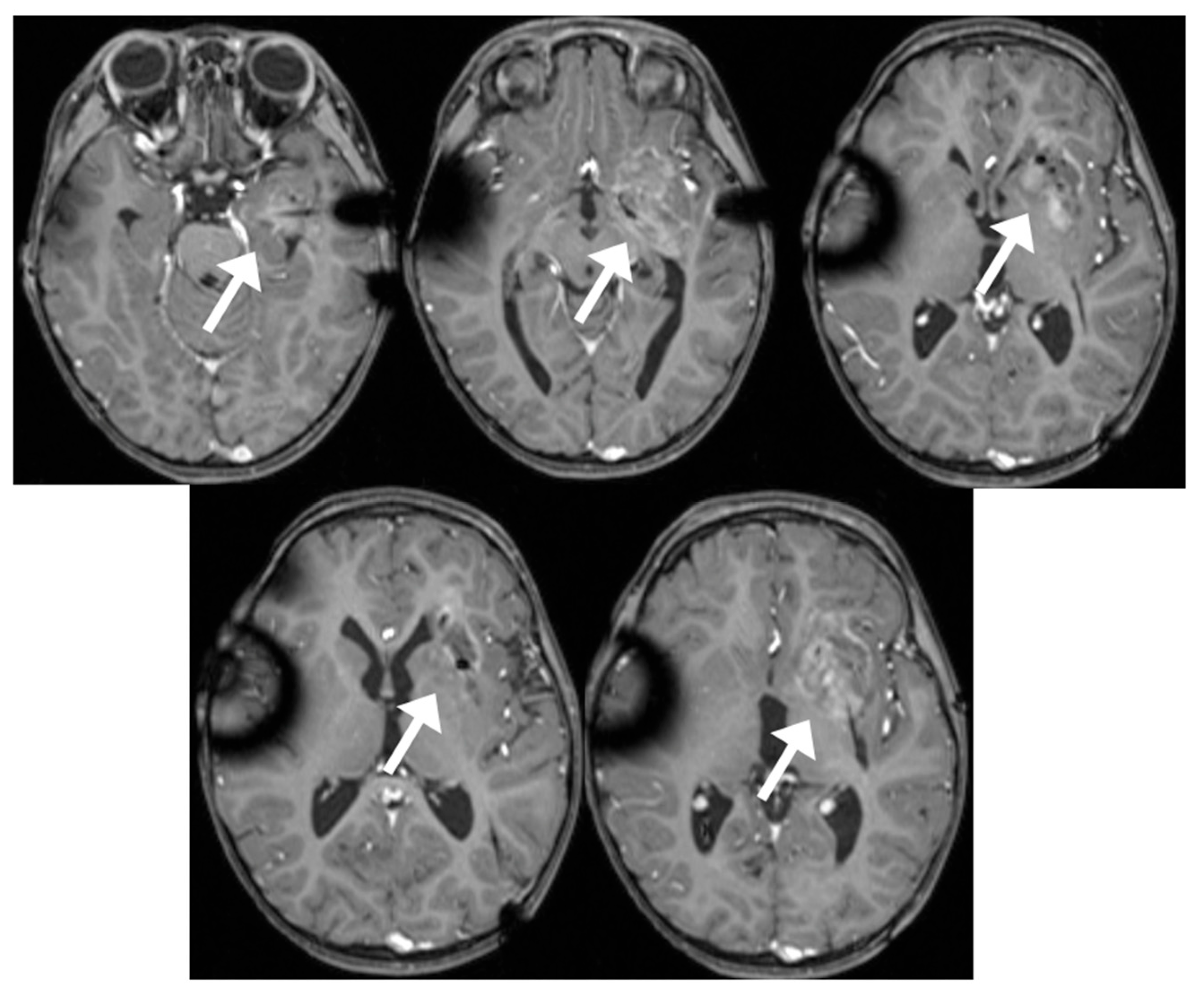 Brainsci 13 01515 g005