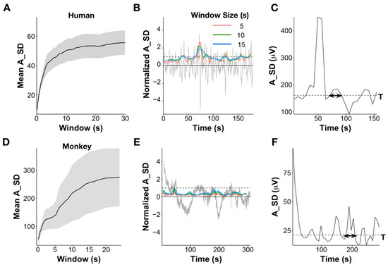 eeg 2011年 Not All Errors Are Alike: Theta and Alpha EEG Dynamics