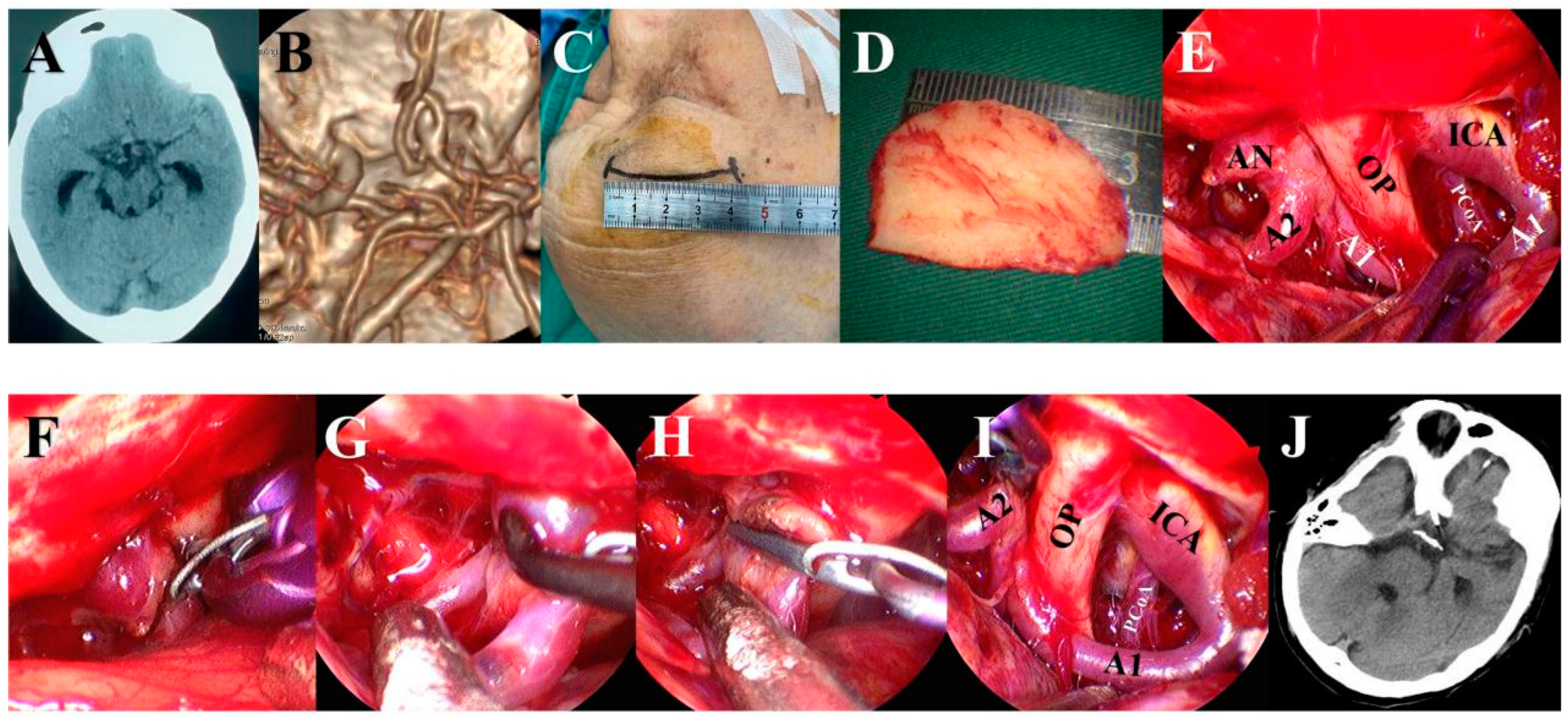 Brainsci 13 01544 g002 Brainsci 13 01544 g002