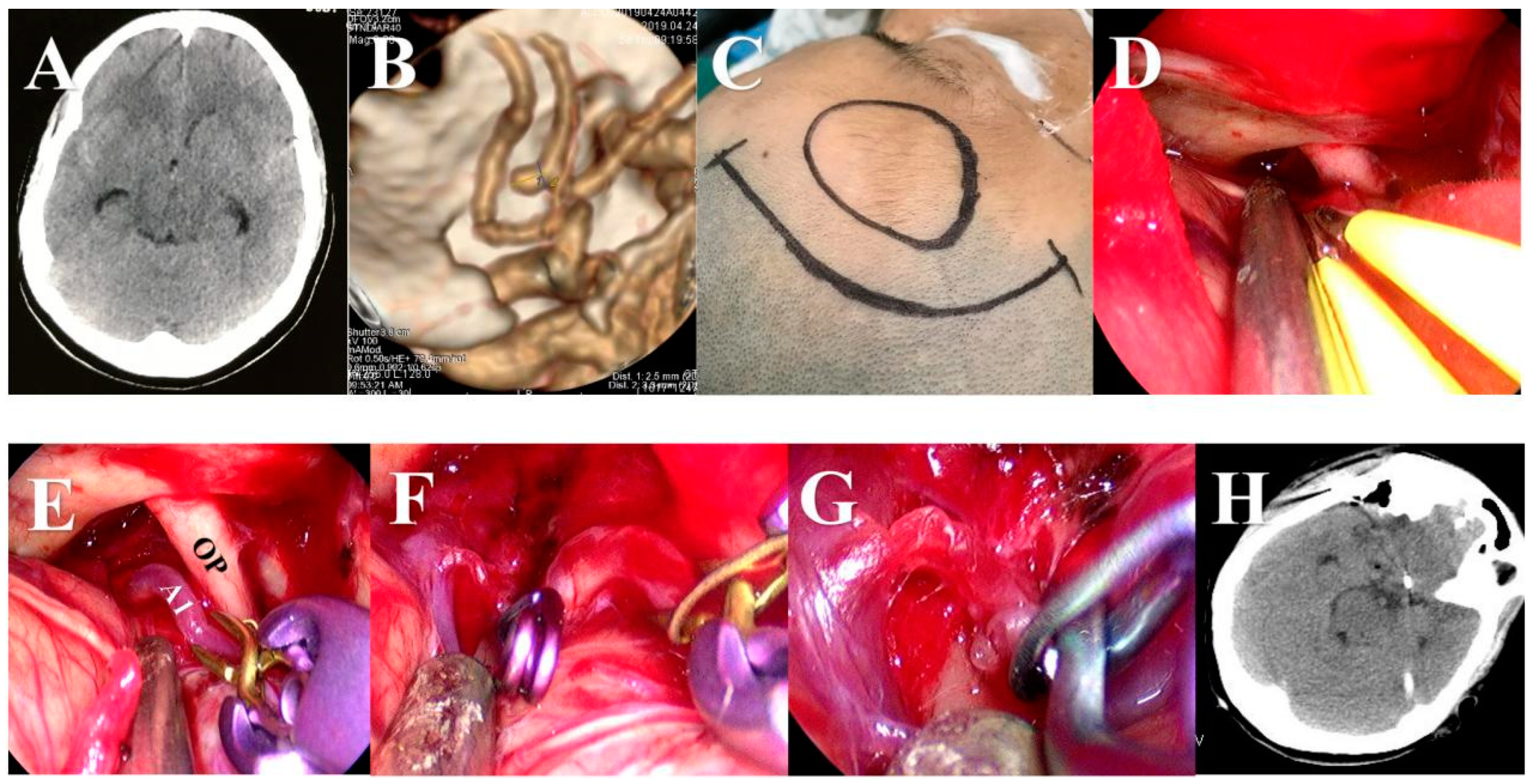 Brainsci 13 01544 g003 Brainsci 13 01544 g003