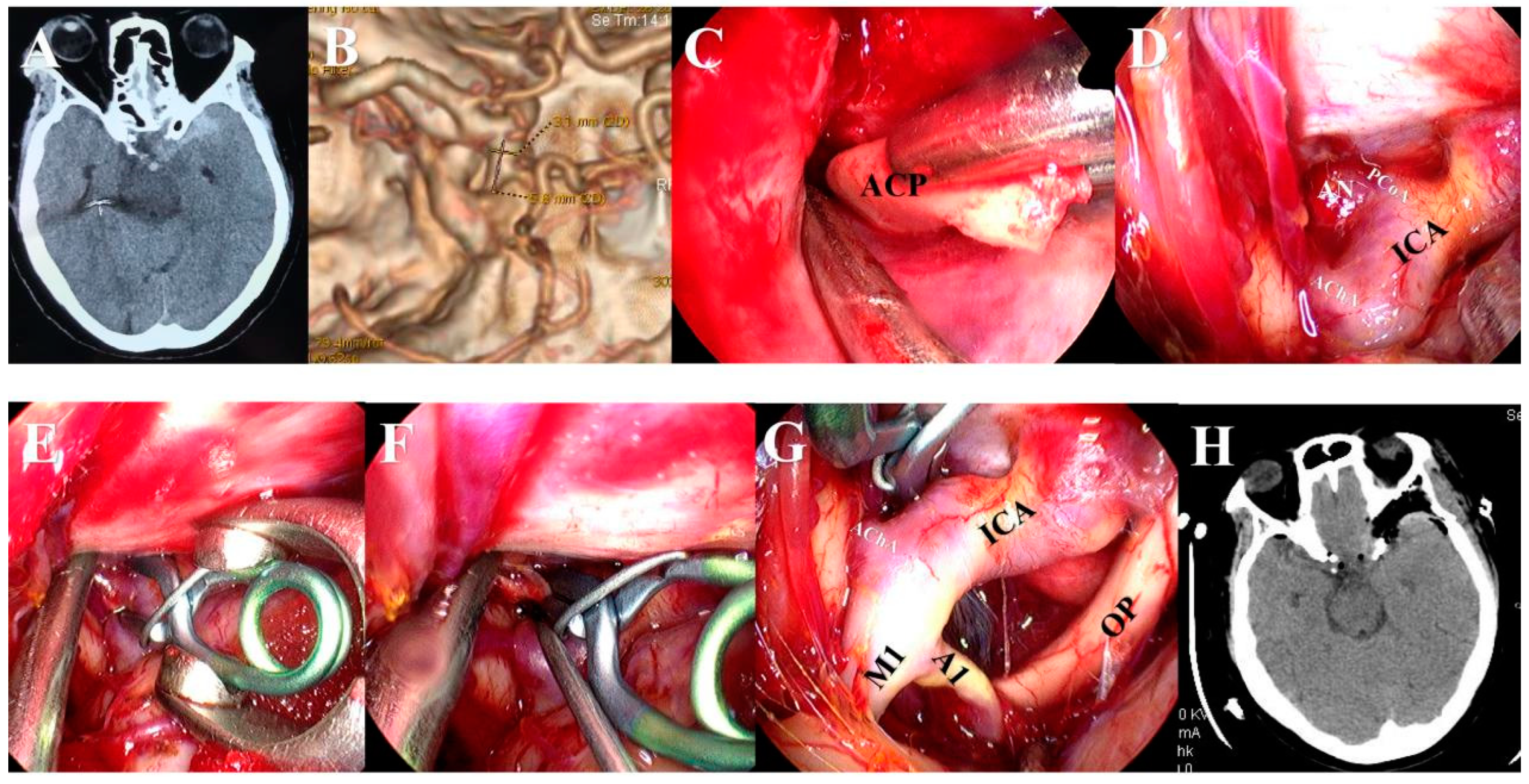 Brainsci 13 01544 g004 Brainsci 13 01544 g004
