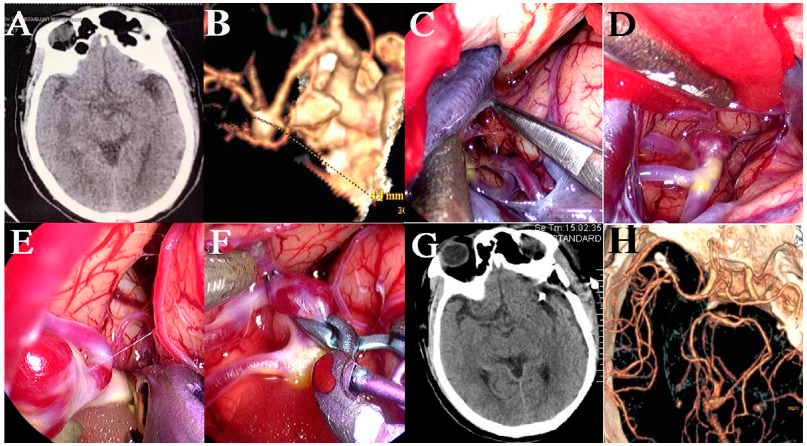 Brainsci 13 01544 g005 Brainsci 13 01544 g005