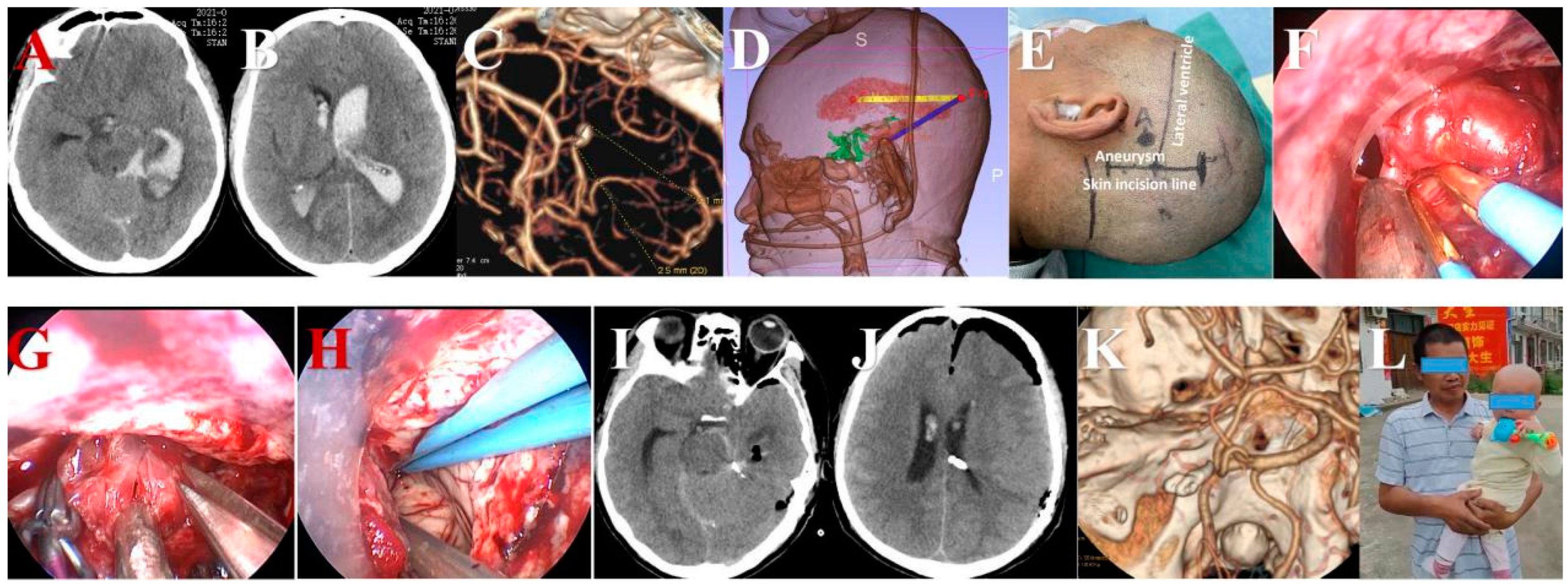 Brainsci 13 01544 g008 Brainsci 13 01544 g008