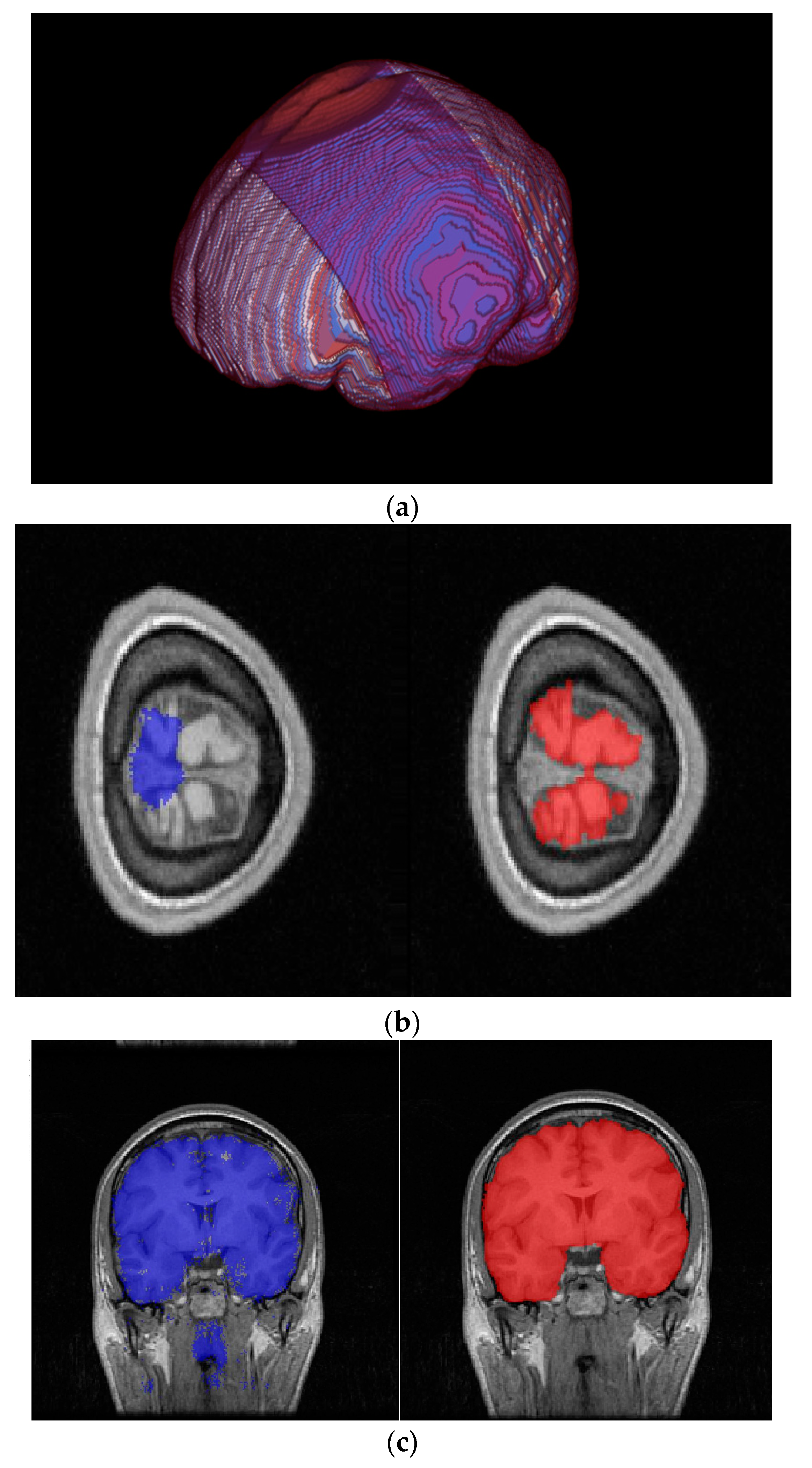 Brainsci 13 01549 g005