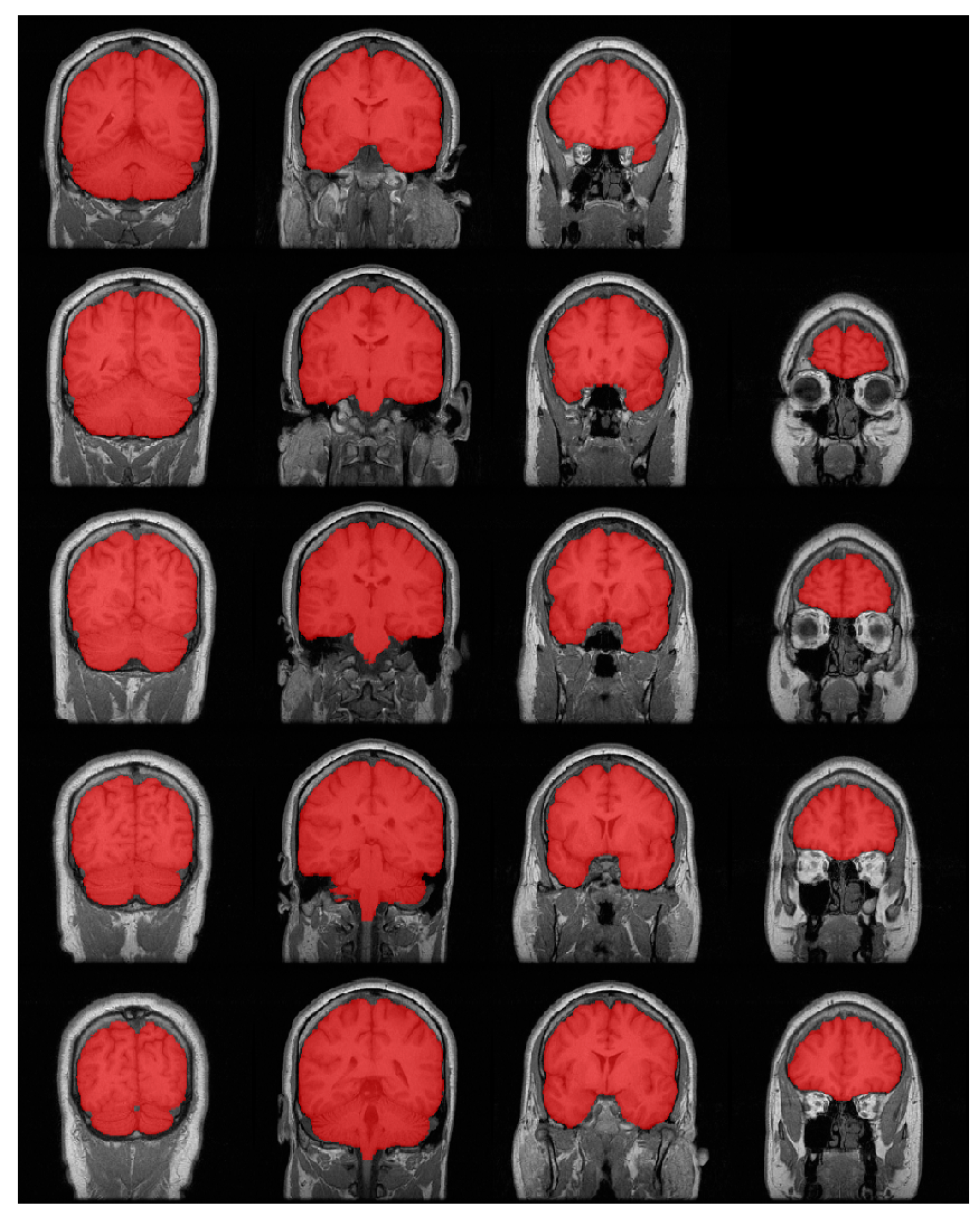 Brainsci 13 01549 g007