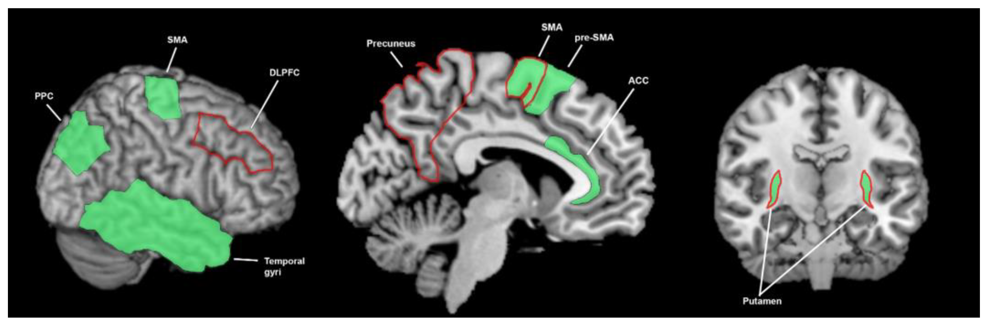 Brainsci 13 01552 g004 Brainsci 13 01552 g004