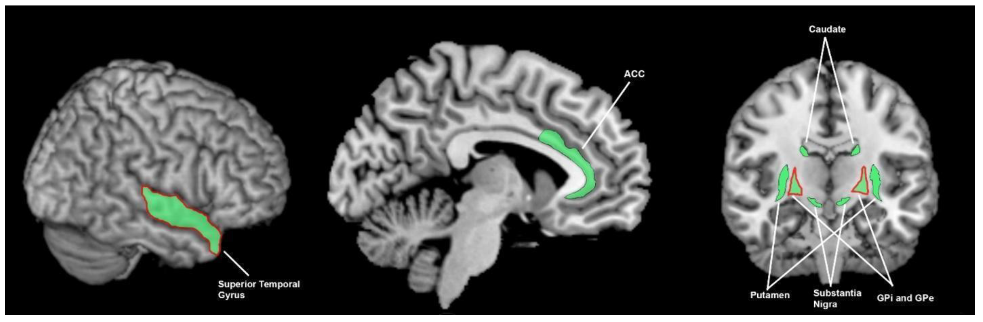 Brainsci 13 01552 g005 Brainsci 13 01552 g005