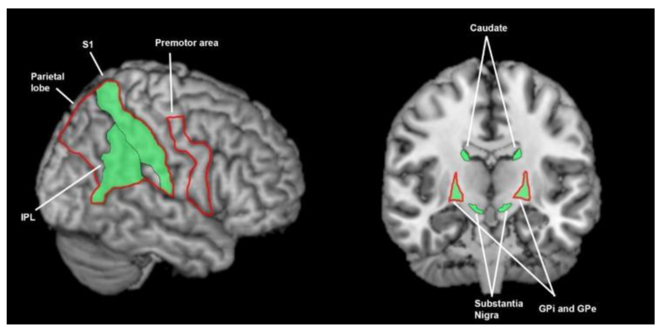 Brainsci 13 01552 g007 Brainsci 13 01552 g007