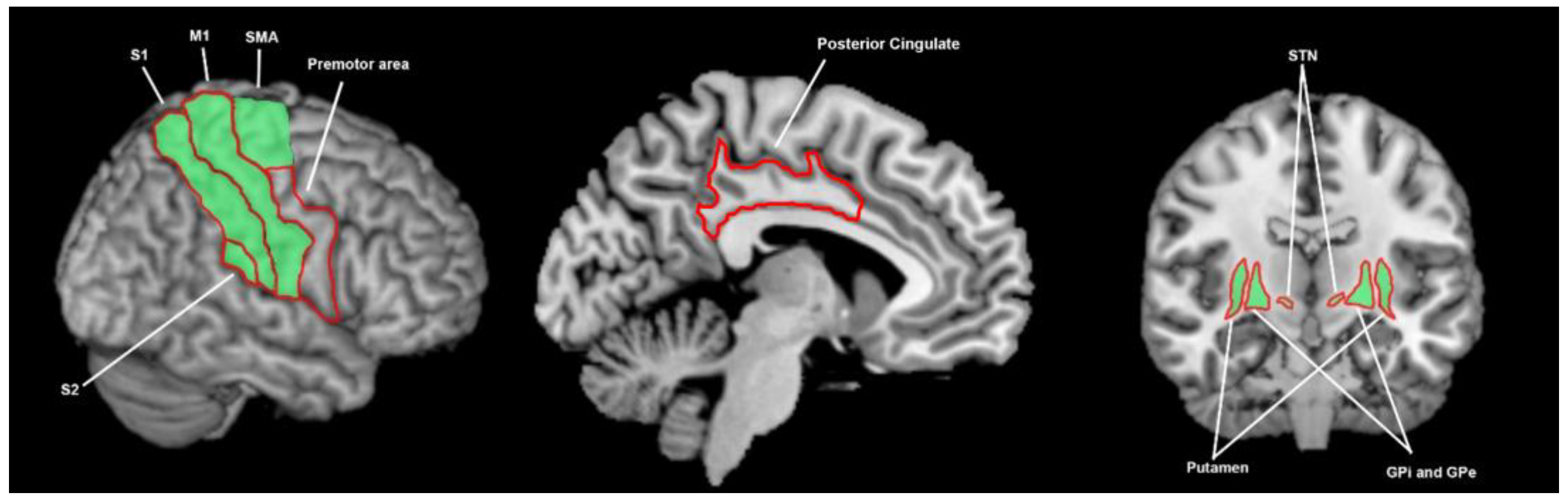 Brainsci 13 01552 g008 Brainsci 13 01552 g008