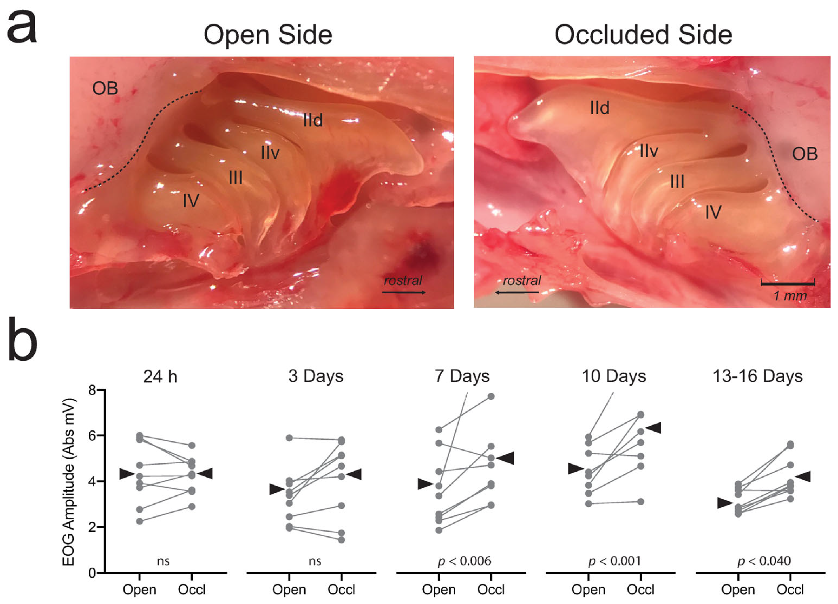 Brainsci 13 01553 g003 Brainsci 13 01553 g003