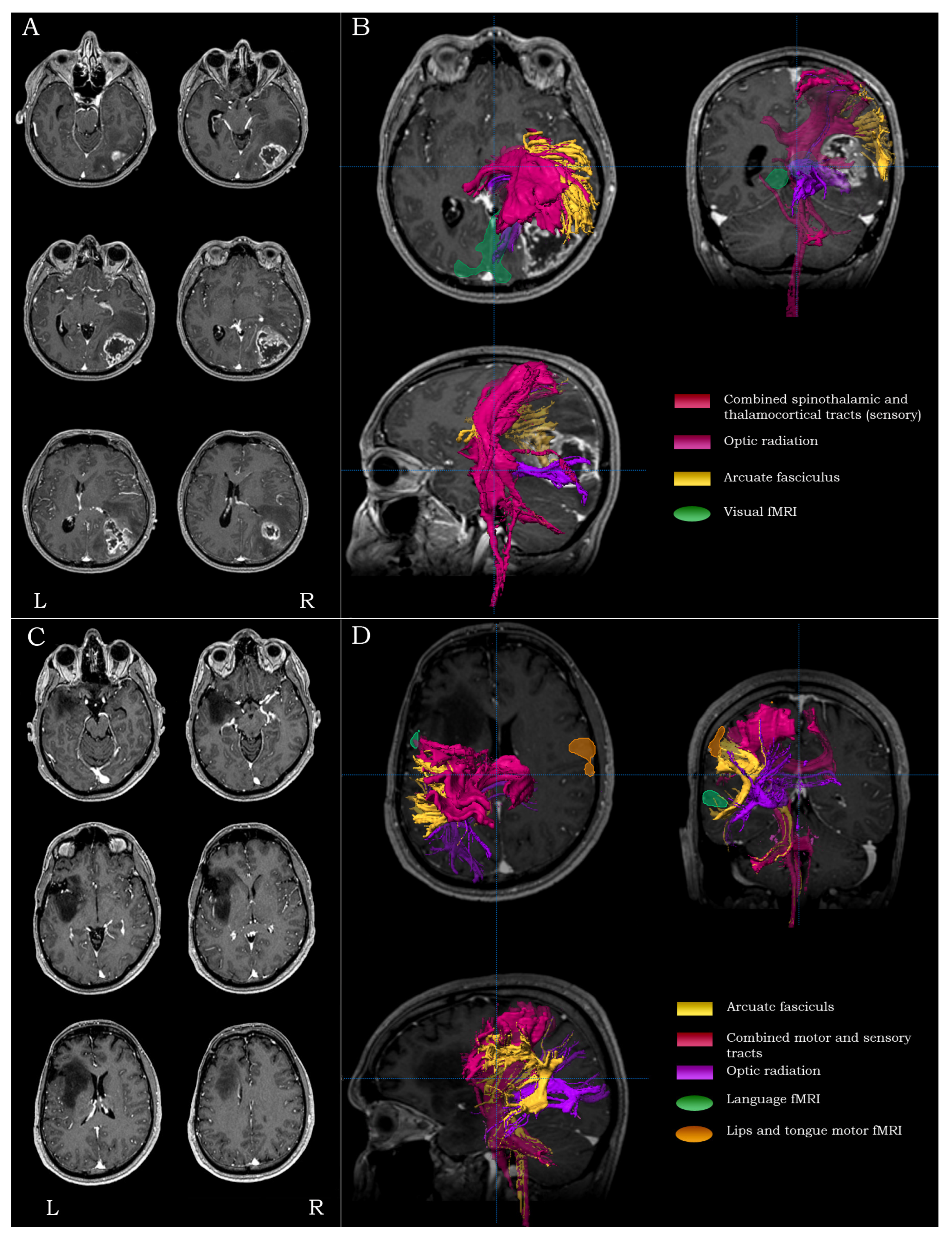 Brainsci 13 01574 g004 Brainsci 13 01574 g004