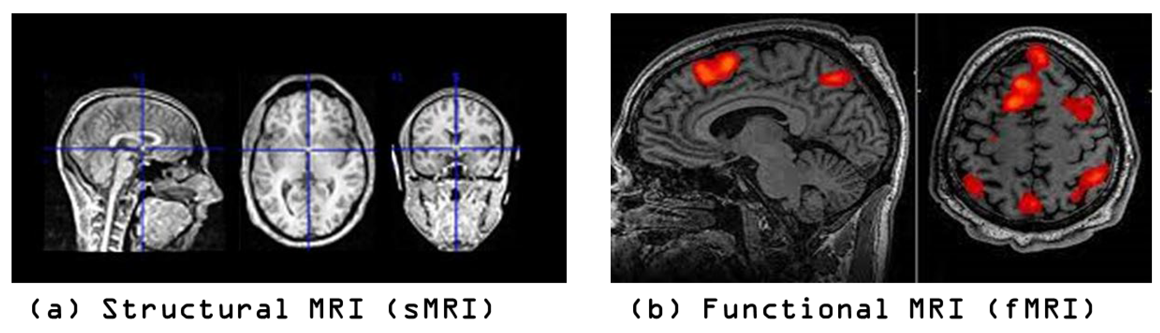 Multi-Slice Generation sMRI and fMRI for Autism Spectrum Disorder ...