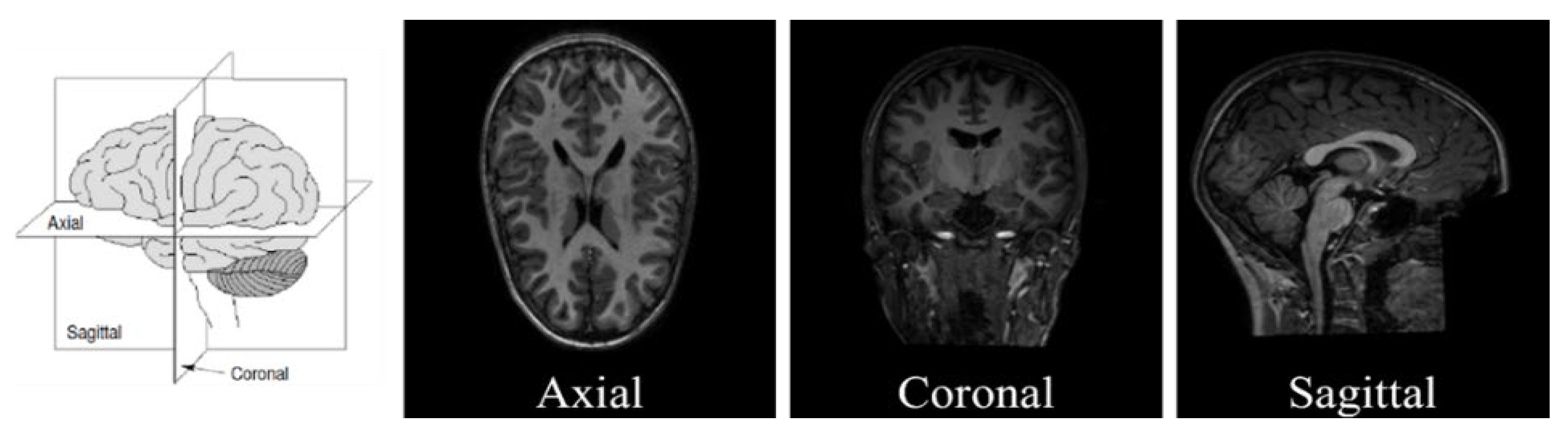 Brainsci 13 01578 g004