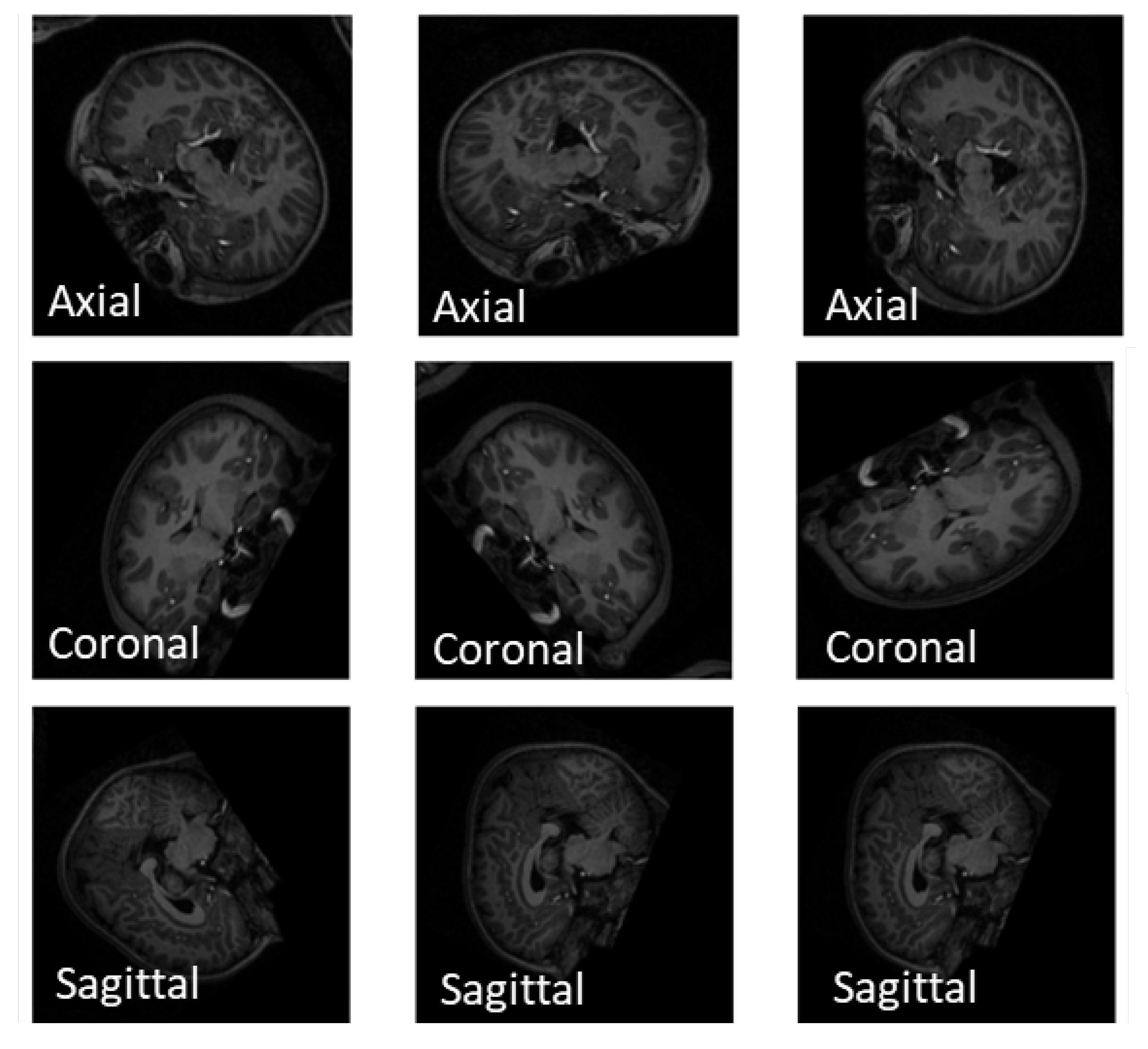 Brainsci 13 01578 g005