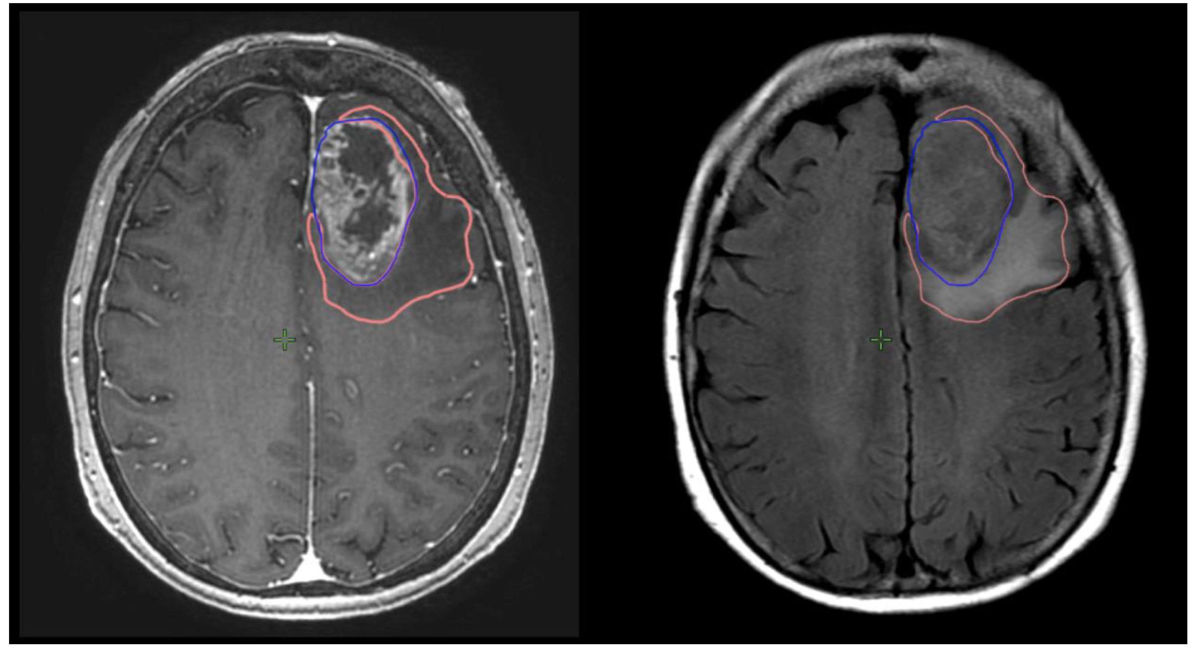 Brainsci 13 01579 g001