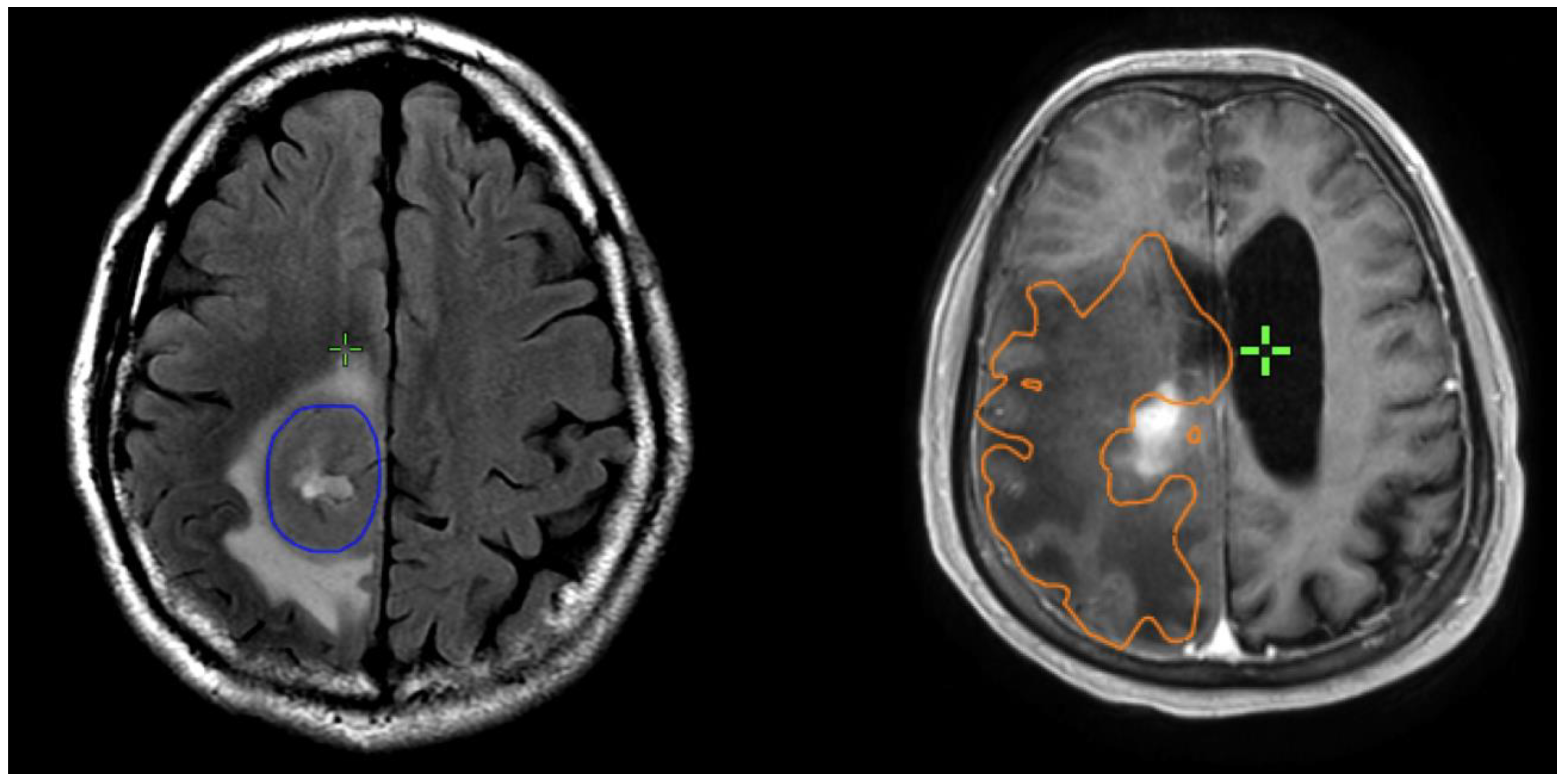 Brainsci 13 01579 g002