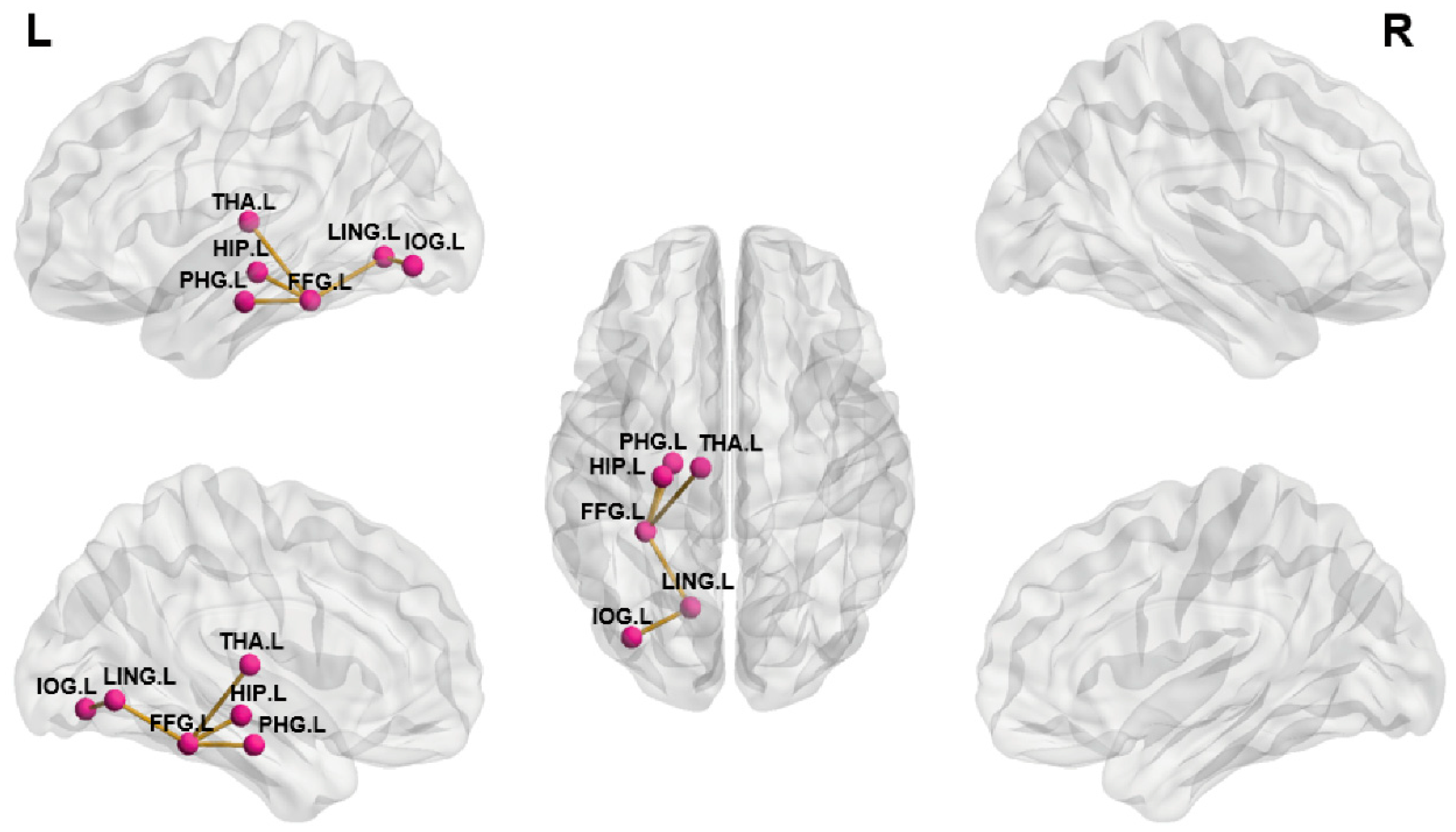 Brainsci 13 01597 g004