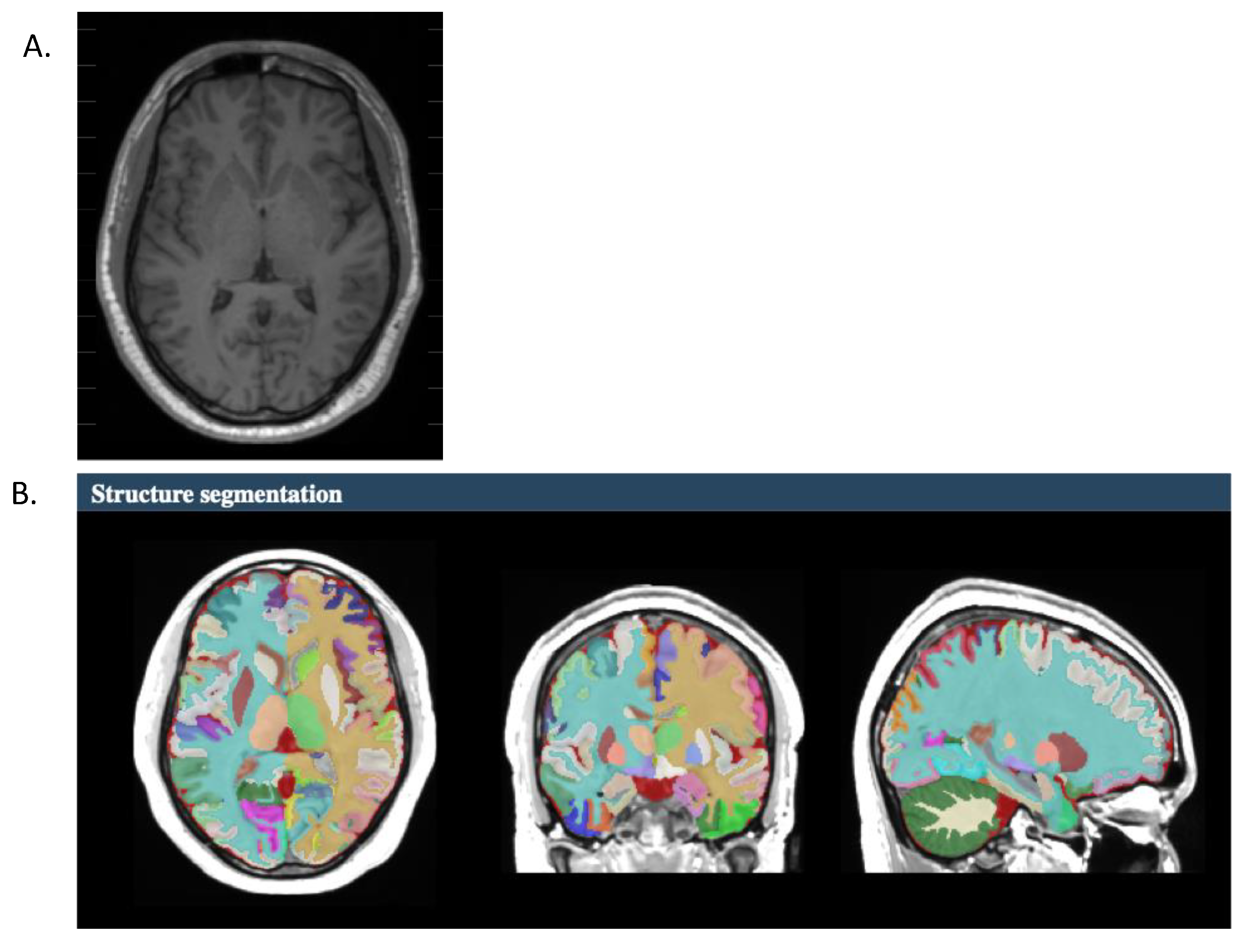 Brainsci 13 01622 g001