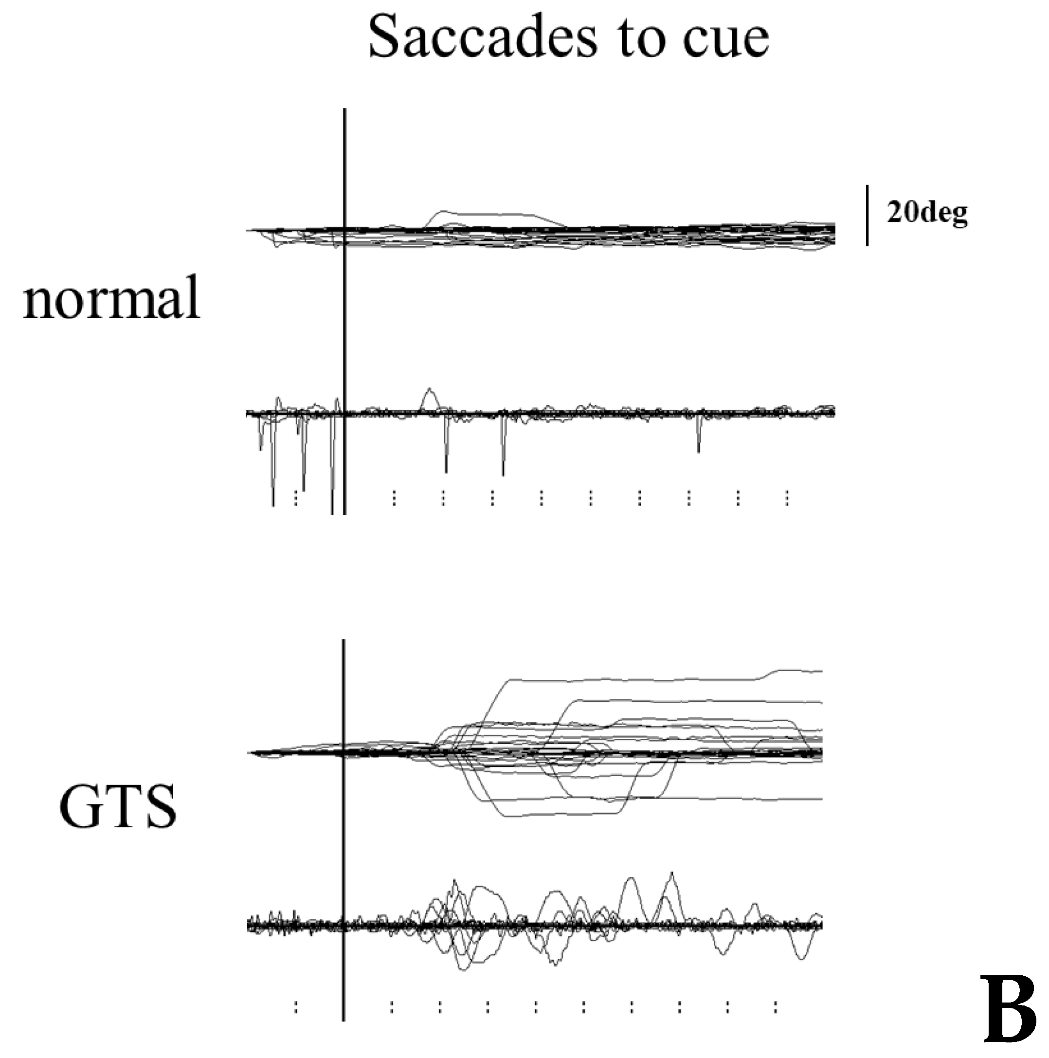 Brainsci 13 01634 g005b