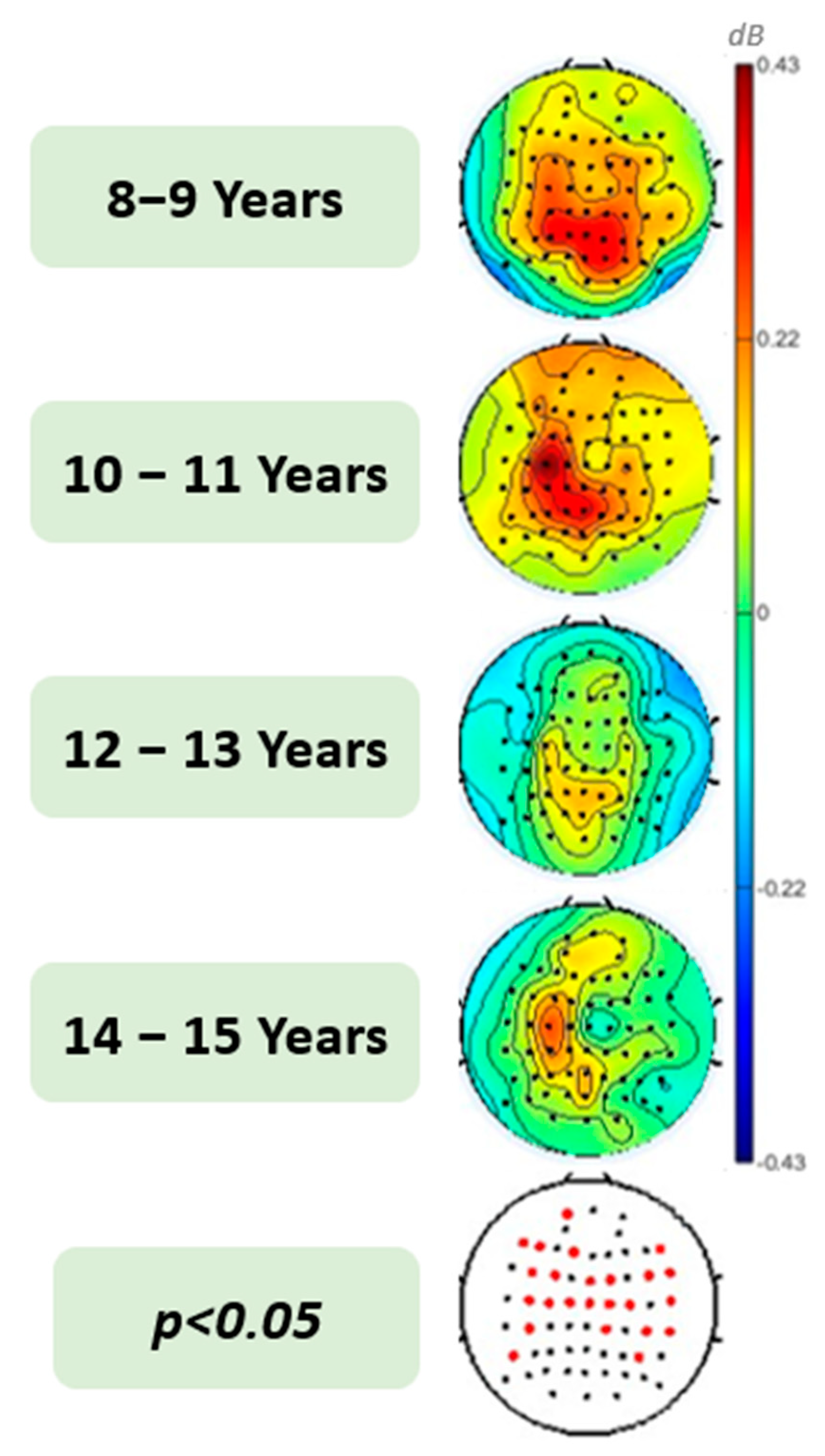 Brain Sciences Free FullText Development of Gamma Oscillation during Sentence Processing in