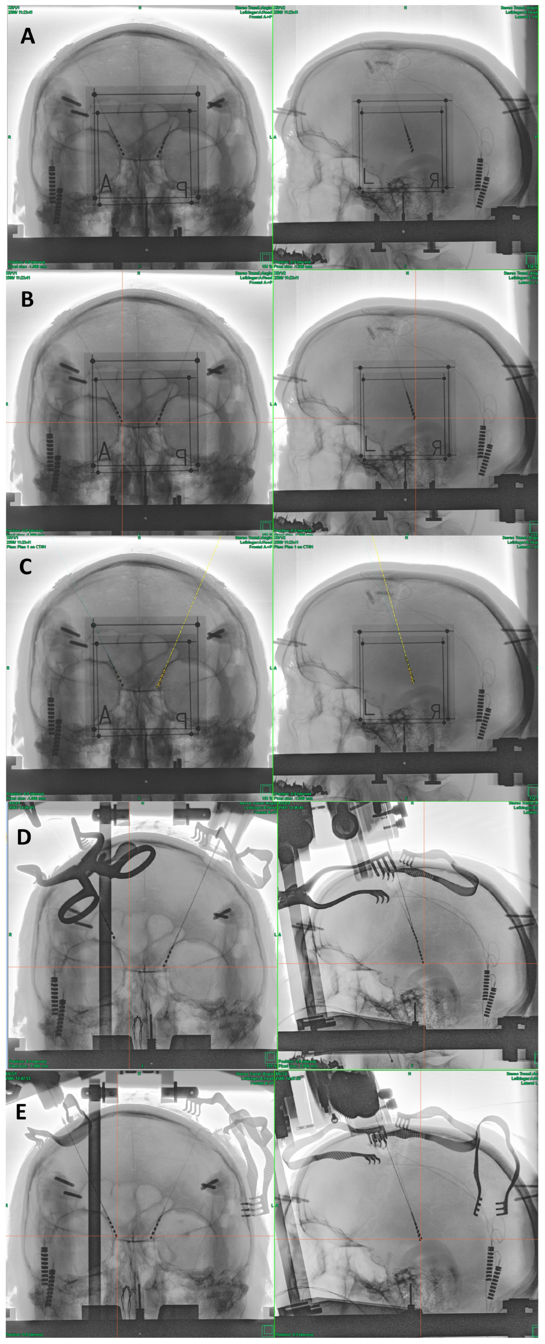 Brainsci 13 01650 g001
