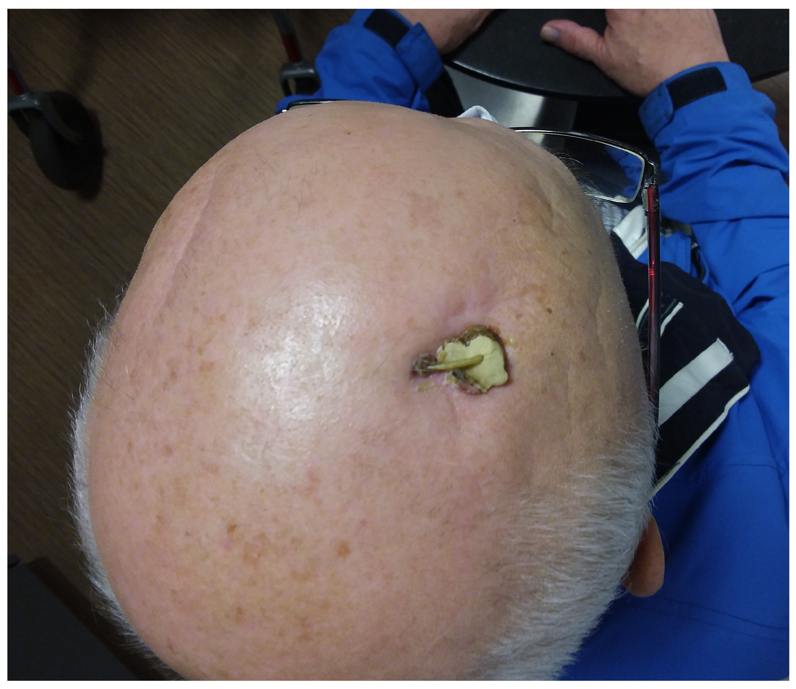 Brainsci 13 01650 g003