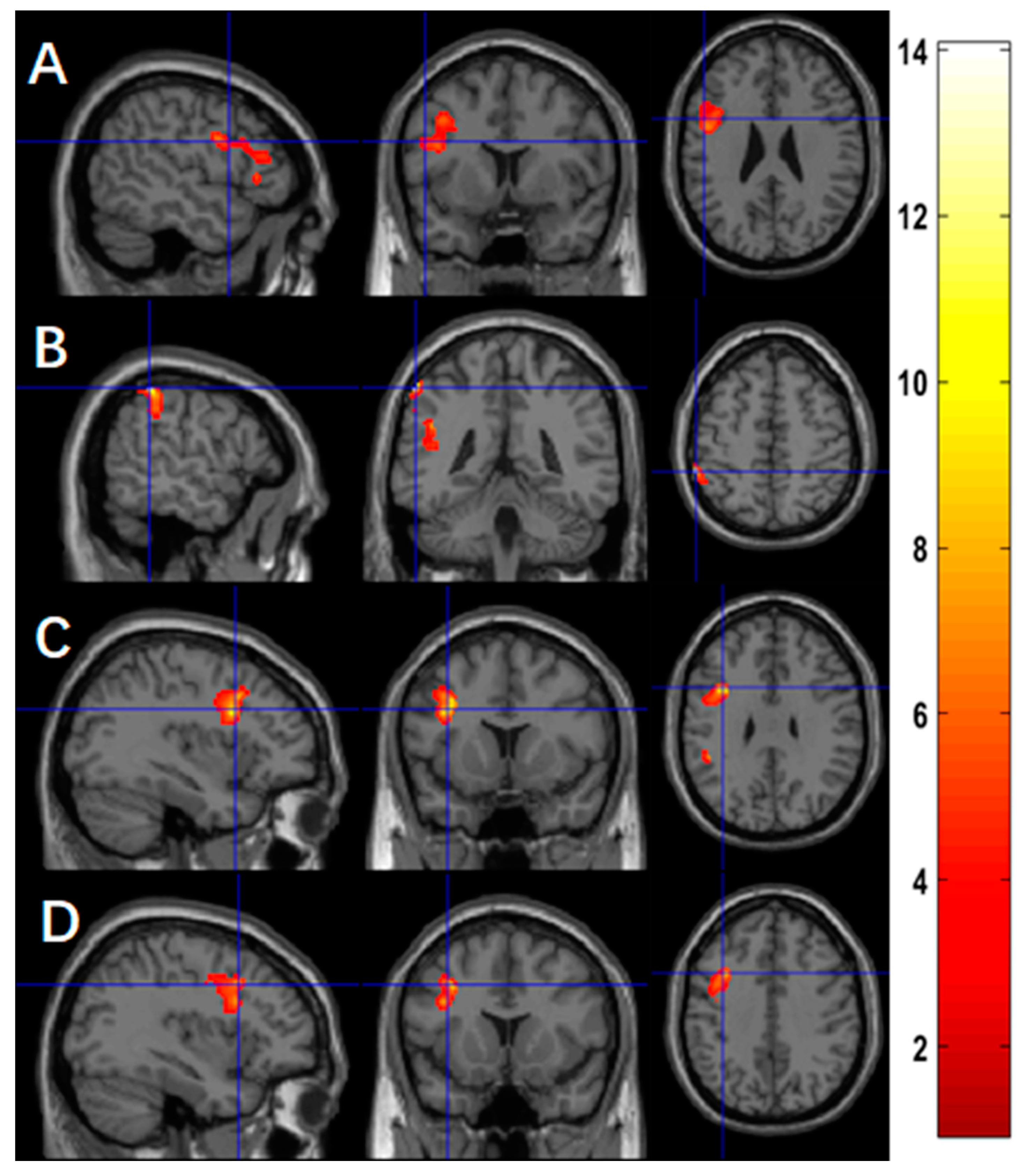 Brainsci 13 01653 g004