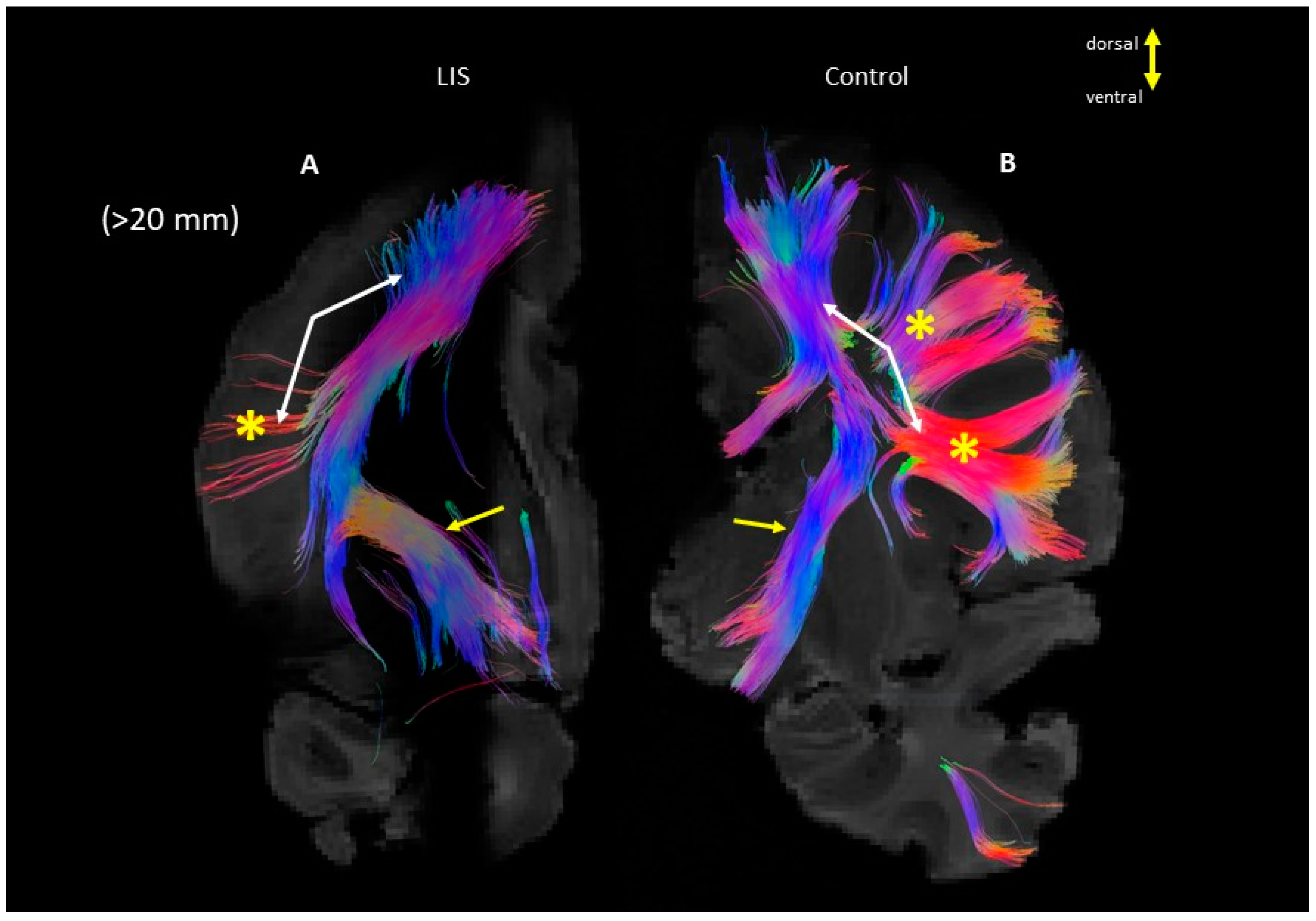Brainsci 13 01655 g004