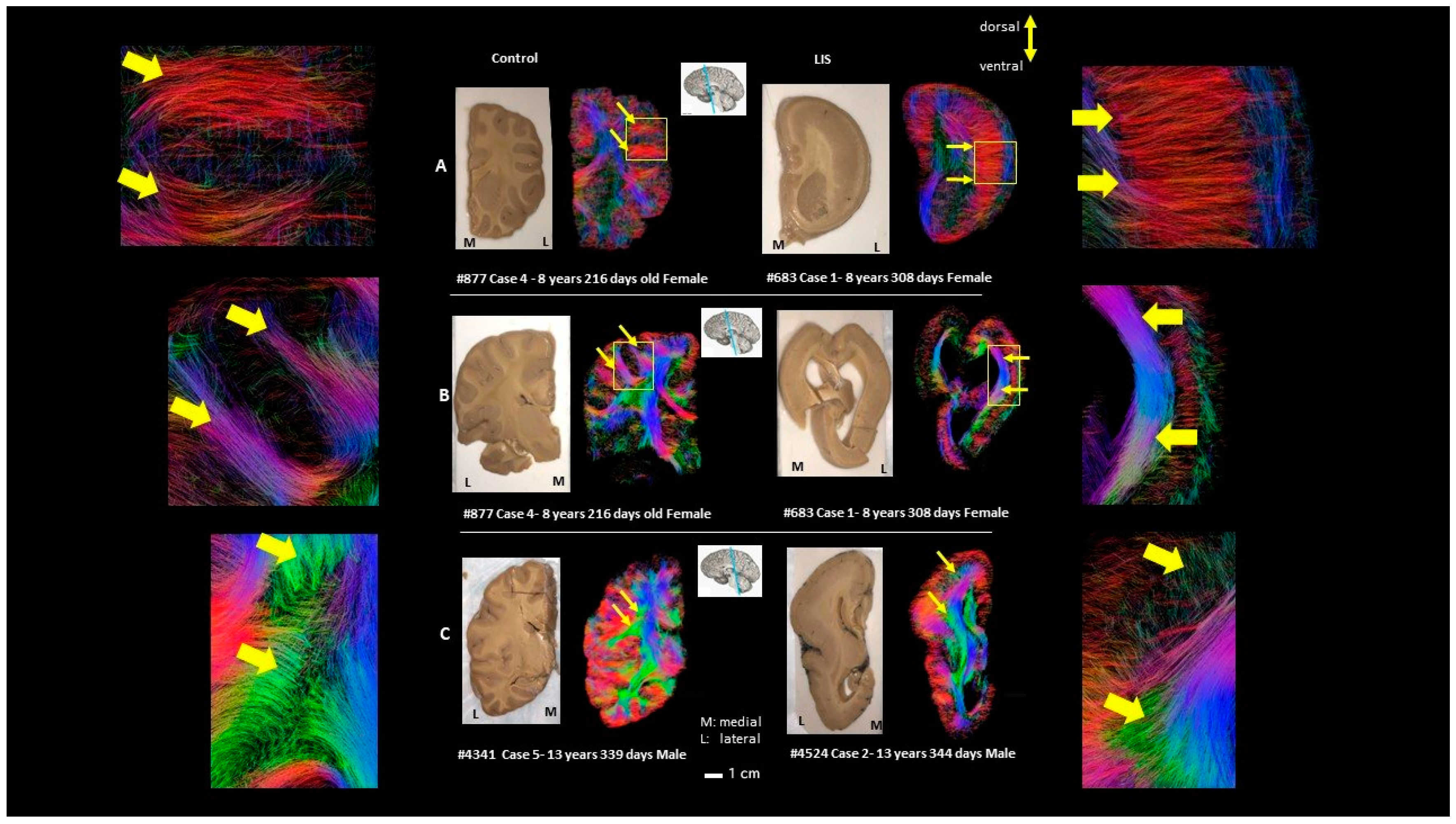 Brainsci 13 01655 g005