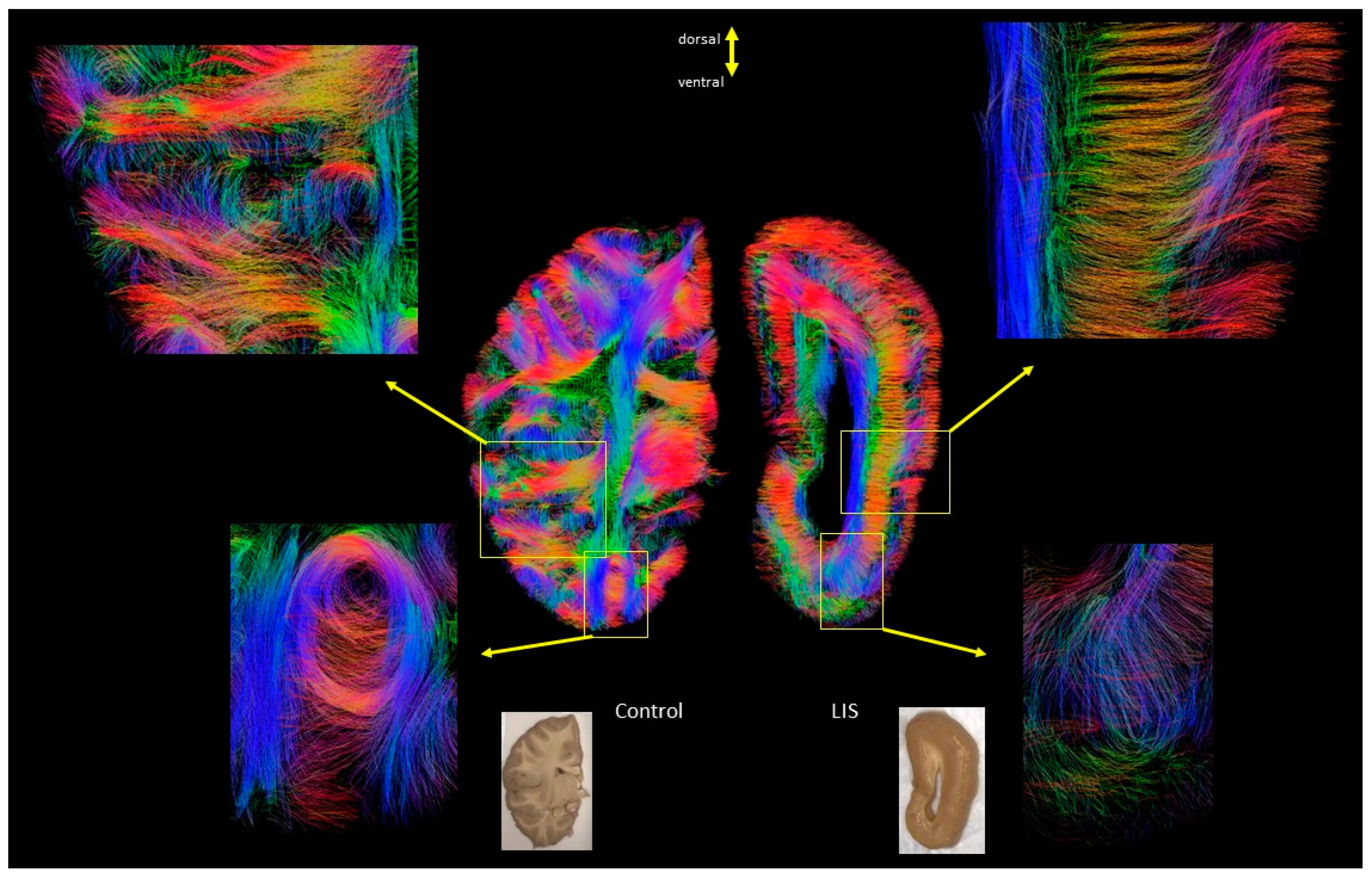 Brainsci 13 01655 g006