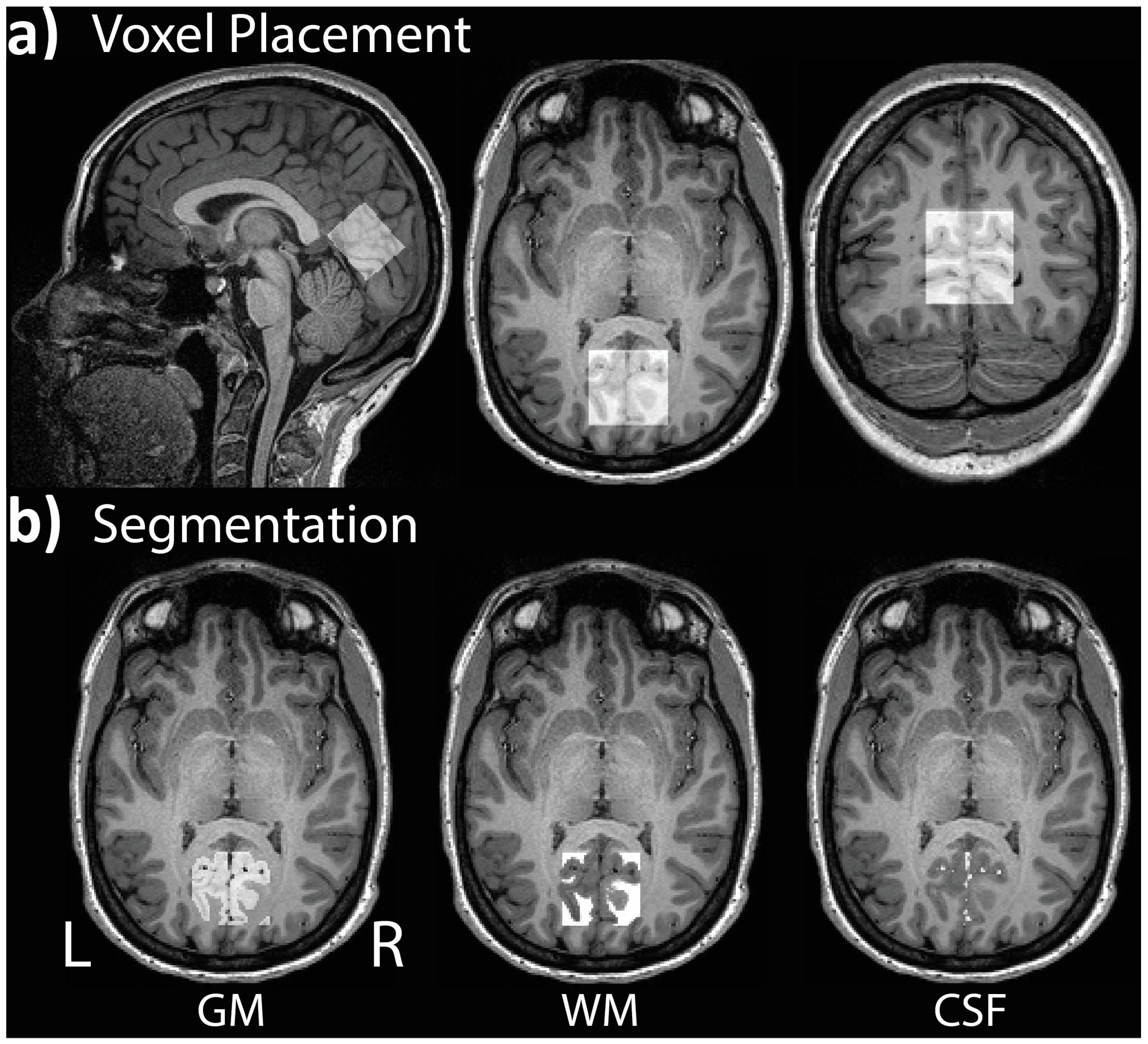 Brainsci 13 01666 g003